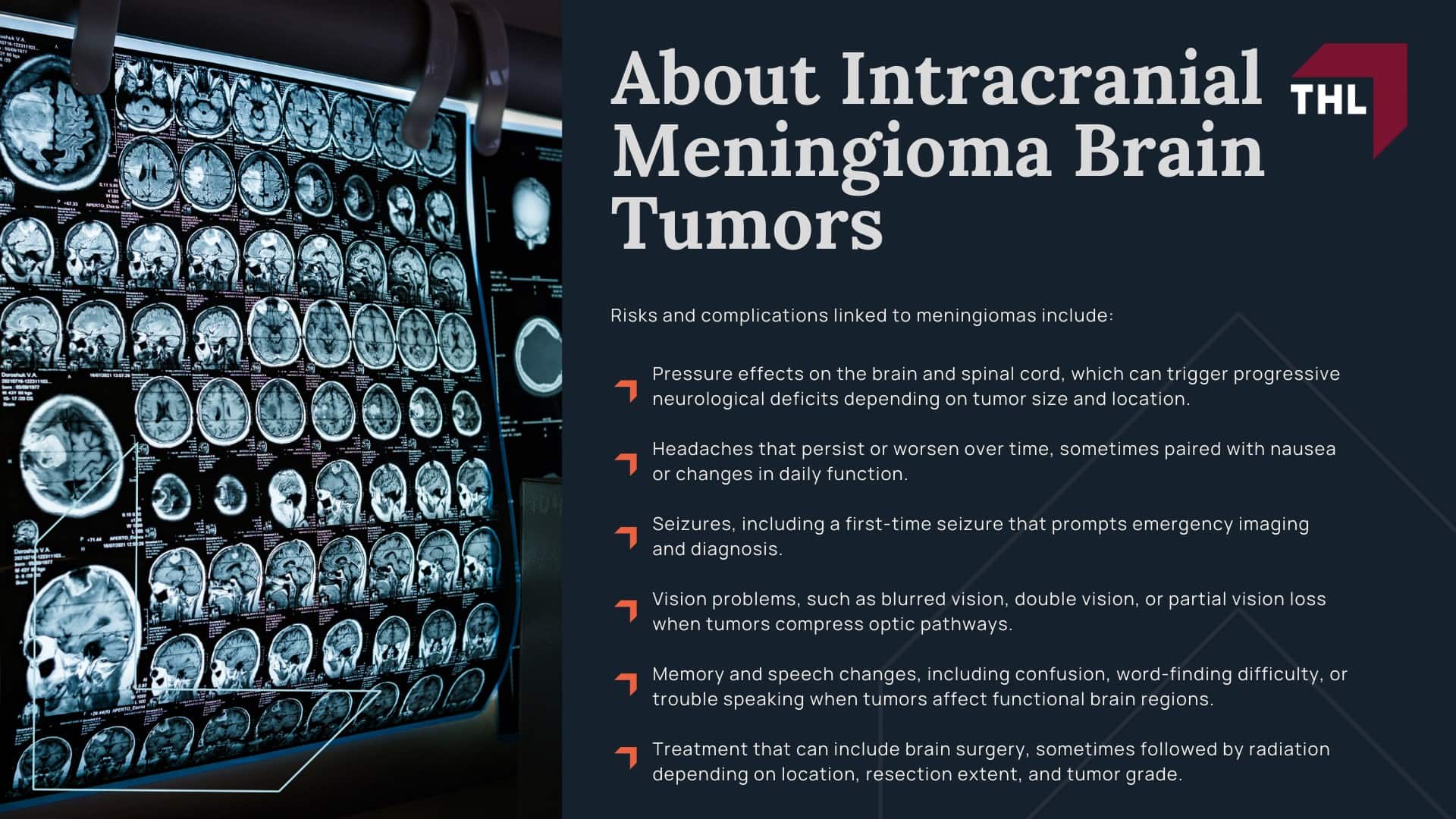 FDA Approves Label Change for Depo-Provera: Brain Tumor Risk; Is The New Depo-Provera Label Update a Black Box Warning?; Depo-Provera Warning Label Update Brain Tumor Risk Recognized - Depo-Provera Lawsuit Overview - torhoerman law; Is There a Depo-Provera Class Action Lawsuit?; Depo-Provera Lawsuit Settlement Projections: Potential Financial Compensation; About Intracranial Meningioma Brain Tumors; About Intracranial Meningioma Brain Tumors