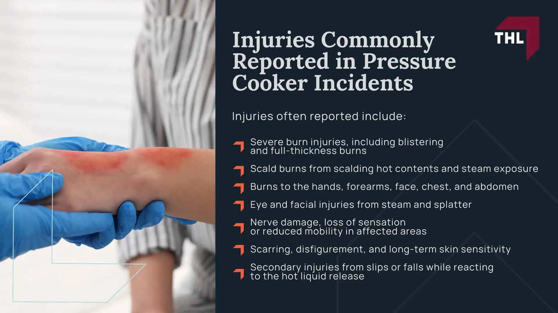 Amazon Pressure Cooker Lawsuit - Amazon Pressure Cooker Lawsuit Overview - torhoerman law; Amazon Pressure Cooker Lawsuit - Pressure Cookers Sold on Amazon How the Sales Channel Works - torhoerman law; Amazon Pressure Cooker Lawsuit - Pressure Cooker Recalls Connected to Products Sold on Amazon - torhoerman law; Amazon Pressure Cooker Lawsuit - Can Amazon Be Named in a Lawsuit for a Defective Pressure Cooker Sold on Its Website - torhoerman law; Amazon Pressure Cooker Lawsuit - Defects Alleged in Pressure Cooker Injury Claims - torhoerman law; Amazon Pressure Cooker Lawsuit - Injuries Commonly Reported in Pressure Cooker Incidents - torhoerman law
