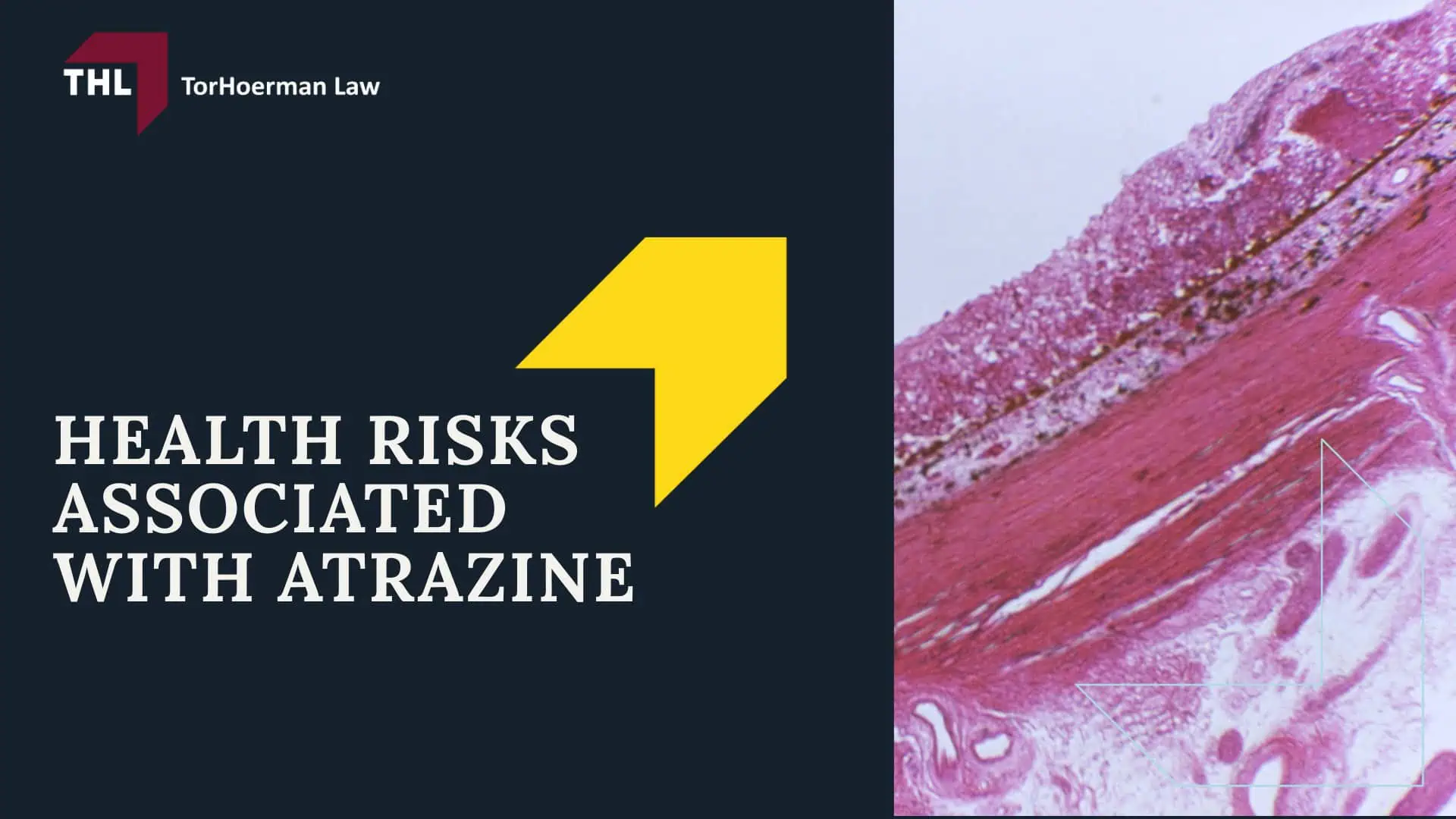 Atrazine Lawsuit - Overview of the Atrazine Lawsuit Investigation - torhoerman law; Atrazine Lawsuit - What is Atrazine - torhoerman law; Atrazine Lawsuit - What Company Produces Atrazine - torhoerman law; Atrazine Lawsuit - Health Risks Associated With Atrazine - torhoerman law