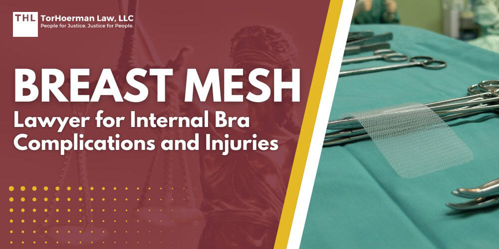 Breast Mesh Lawyer for Internal Bra Complications and Injuries; Overview of Breast Mesh and Internal Bra Surgery; Types of Mesh Used in Breast Procedures; Injuries and Complications Linked to Breast Mesh; Who May Qualify for a Breast Mesh Lawsuit; Manufacturers and Products Under Investigation; What a Breast Mesh Lawyer Does in Your Case; Evidence to Bring to a Breast Mesh Lawyer; Potential Compensation in Breast Mesh Cases; TorHoerman Law_ Contact a Breast Mesh Lawyer Today