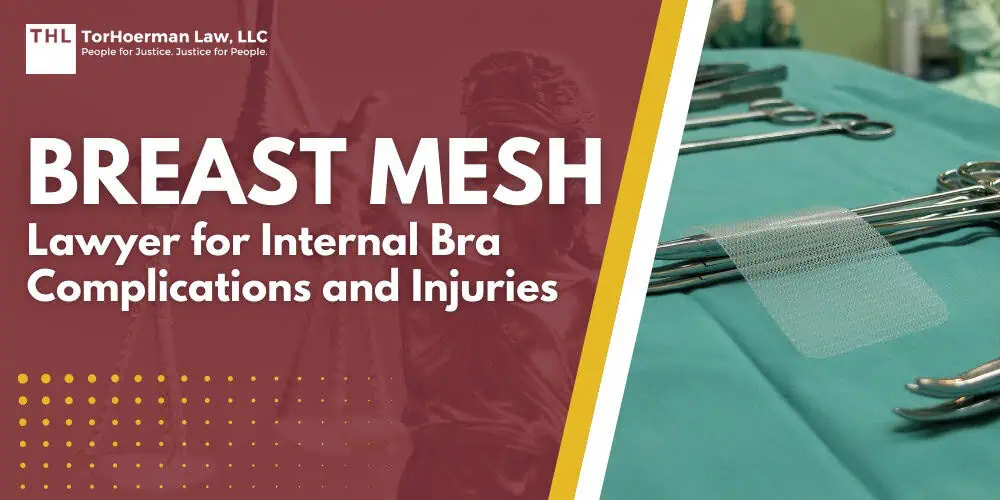 Breast Mesh Lawyer for Internal Bra Complications and Injuries