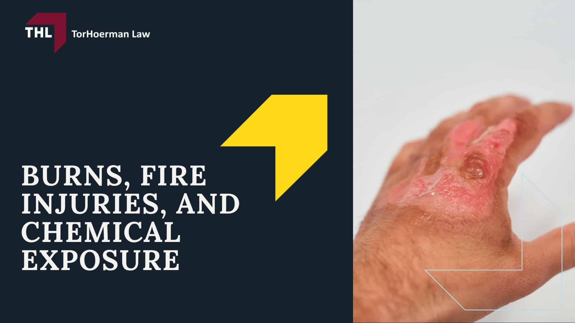 Common Truck Accident Injuries - Internal Injuries and Organ Damage - torhoerman law; Common Truck Accident Injuries - Back Injuries and Chronic Pain Conditions - torhoerman law; Common Truck Accident Injuries - Burns, Fire Injuries, and Chemical Exposure - torhoerman law