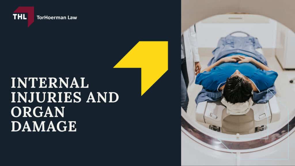 Common Truck Accident Injuries | TorHoerman Law