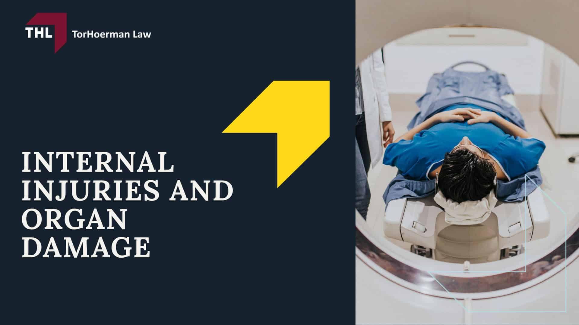 Common Truck Accident Injuries - Common Truck Accident Injuries - torhoerman law; Common Truck Accident Injuries - Common Truck Accident Scenarios That Cause Serious Injury - torhoerman law; Common Truck Accident Injuries - Traumatic Brain Injuries (TBI) Caused by Truck Accidents - torhoerman law; Common Truck Accident Injuries - Spinal Cord Injuries and Paralysis - torhoerman law; Common Truck Accident Injuries - Neck Injuries and Whiplash - torhoerman law; Common Truck Accident Injuries - Broken Bones and Crush Injuries - torhoerman law; Common Truck Accident Injuries - Internal Injuries and Organ Damage - torhoerman law