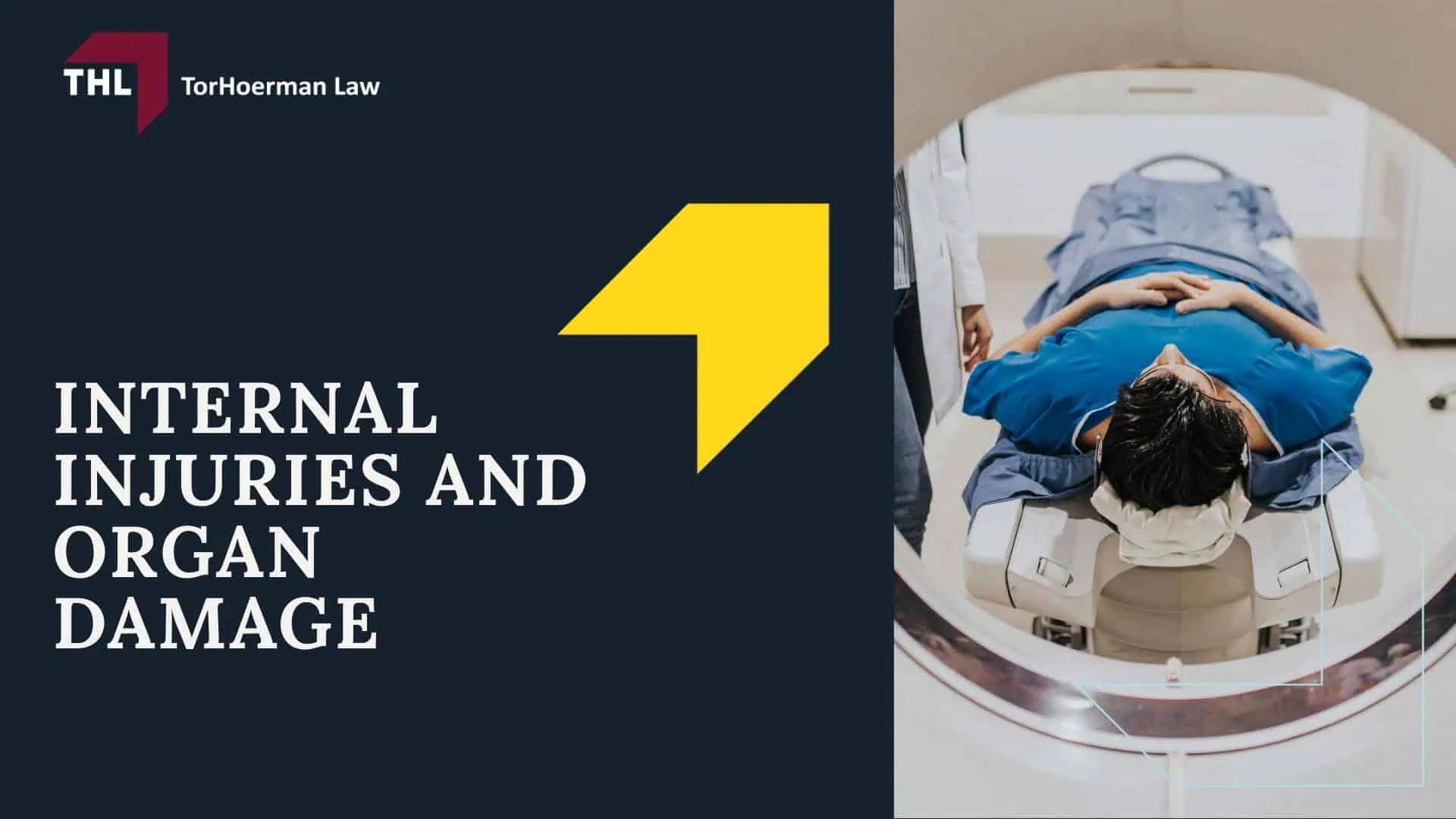 Common Truck Accident Injuries - Common Truck Accident Injuries - torhoerman law; Common Truck Accident Injuries - Common Truck Accident Scenarios That Cause Serious Injury - torhoerman law; Common Truck Accident Injuries - Traumatic Brain Injuries (TBI) Caused by Truck Accidents - torhoerman law; Common Truck Accident Injuries - Spinal Cord Injuries and Paralysis - torhoerman law; Common Truck Accident Injuries - Neck Injuries and Whiplash - torhoerman law; Common Truck Accident Injuries - Broken Bones and Crush Injuries - torhoerman law; Common Truck Accident Injuries - Internal Injuries and Organ Damage - torhoerman law