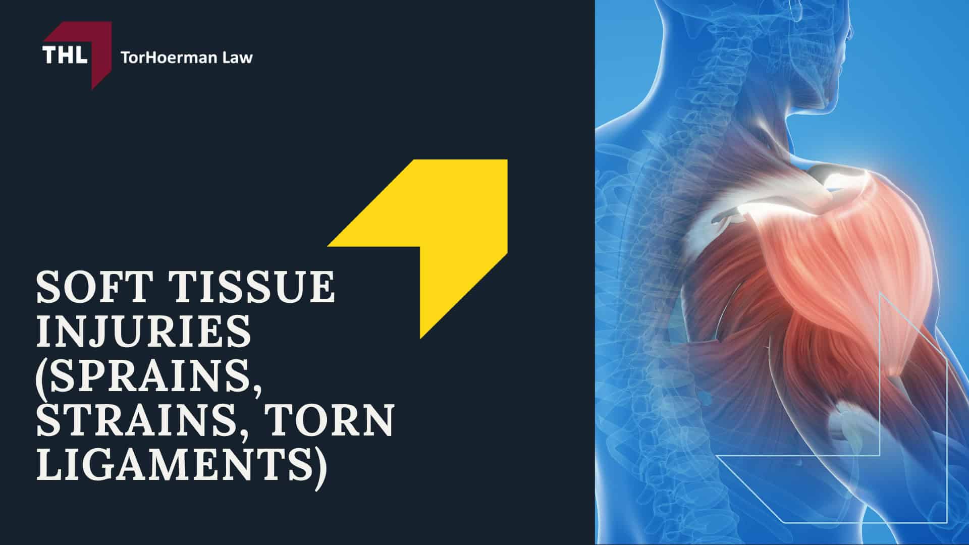 Common Truck Accident Injuries - Internal Injuries and Organ Damage - torhoerman law; Common Truck Accident Injuries - Back Injuries and Chronic Pain Conditions - torhoerman law; Common Truck Accident Injuries - Burns, Fire Injuries, and Chemical Exposure - torhoerman law; Common Truck Accident Injuries - Lacerations, Facial Injuries, and Disfigurement - torhoerman law; Common Truck Accident Injuries - Amputations and Limb Loss - torhoerman law;  Common Truck Accident Injuries - Soft Tissue Injuries (Sprains, Strains, Torn Ligaments) - torhoerman law