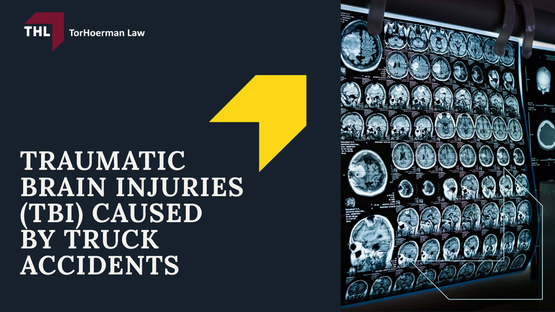 Common Truck Accident Injuries - Common Truck Accident Injuries - torhoerman law; Common Truck Accident Injuries - Common Truck Accident Scenarios That Cause Serious Injury - torhoerman law; Common Truck Accident Injuries - Traumatic Brain Injuries (TBI) Caused by Truck Accidents - torhoerman law