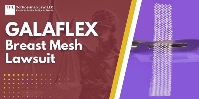 GalaFLEX Breast Mesh Lawsuit; GalaFLEX Breast Mesh Lawsuit - What Is GalaFLEX - torhoerman law; GalaFLEX Breast Mesh Lawsuit - How GalaFLEX Is Used in Breast Surgery and Internal Support Techniques - torhoerman law; GalaFLEX Breast Mesh Lawsuit - FDA Communications and Labeling Language on Surgical Mesh in Breast Surgery - torhoerman law; GalaFLEX Breast Mesh Lawsuit - Potential Complications Following Breast Surgery Involving Mesh or Scaffolds - torhoerman law; GalaFLEX Breast Mesh Lawsuit - When a Post-Surgical Complication Becomes a Legal Claim - torhoerman law; GalaFLEX Breast Mesh Lawsuit - Do You Qualify for a GalaFLEX-Related Claim Review - torhoerman law; GalaFLEX Breast Mesh Lawsuit - Gathering Evidence for a GalaFLEX Breast Mesh Claim - torhoerman law; GalaFLEX Breast Mesh Lawsuit - Potential Damages in Breast Mesh Claims - torhoerman law; GalaFLEX Breast Mesh Lawsuit - TorHoerman Law Reviewing Breast Mesh Claims Involving GalaFLEX - torhoerman law
