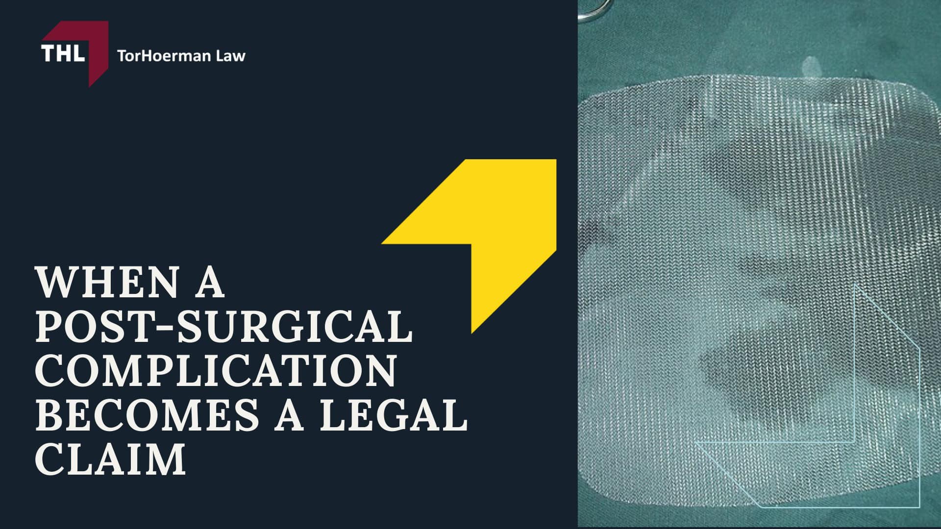 GalaFLEX Breast Mesh Lawsuit - What Is GalaFLEX - torhoerman law; GalaFLEX Breast Mesh Lawsuit - How GalaFLEX Is Used in Breast Surgery and Internal Support Techniques - torhoerman law; GalaFLEX Breast Mesh Lawsuit - FDA Communications and Labeling Language on Surgical Mesh in Breast Surgery - torhoerman law; GalaFLEX Breast Mesh Lawsuit - Potential Complications Following Breast Surgery Involving Mesh or Scaffolds - torhoerman law; GalaFLEX Breast Mesh Lawsuit - When a Post-Surgical Complication Becomes a Legal Claim - torhoerman law