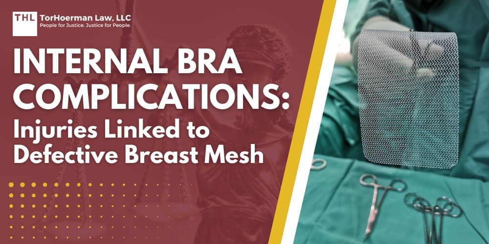 Internal Bra Complications Injuries Linked to Defective Breast Mesh