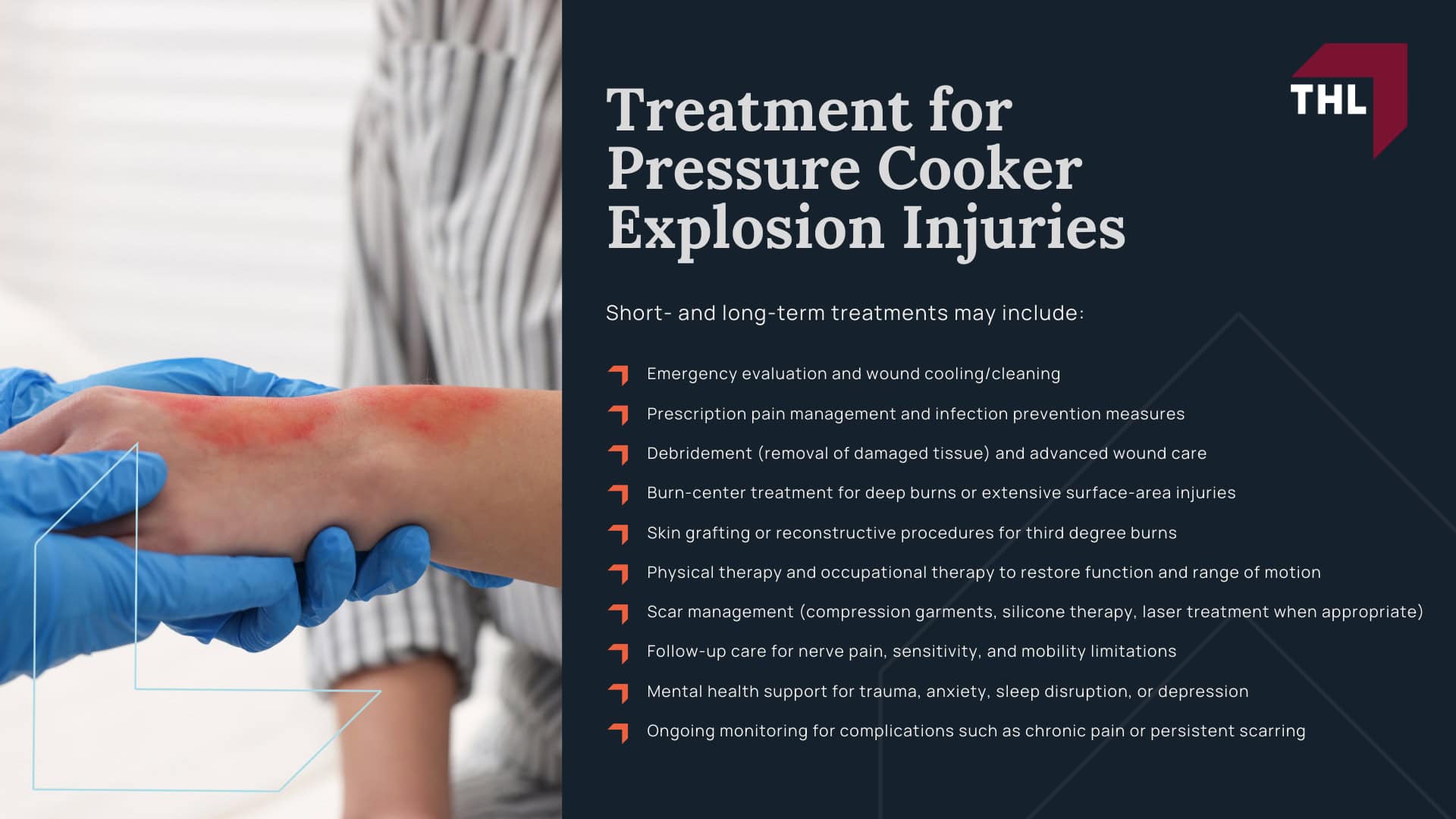 Sensio Pressure Cooker Lawsuit - Sensio Pressure Cooker Lawsuit Overview - Torhoerman law; Sensio Pressure Cooker Lawsuit - What Sensio Pressure Cookers are Recalled_ - Torhoerman law; Sensio Pressure Cooker Lawsuit - Injuries Reported in Defective Pressure Cooker Incidents - Torhoerman law; Sensio Pressure Cooker Lawsuit - Treatment for Pressure Cooker Explosion Injuries - Torhoerman law