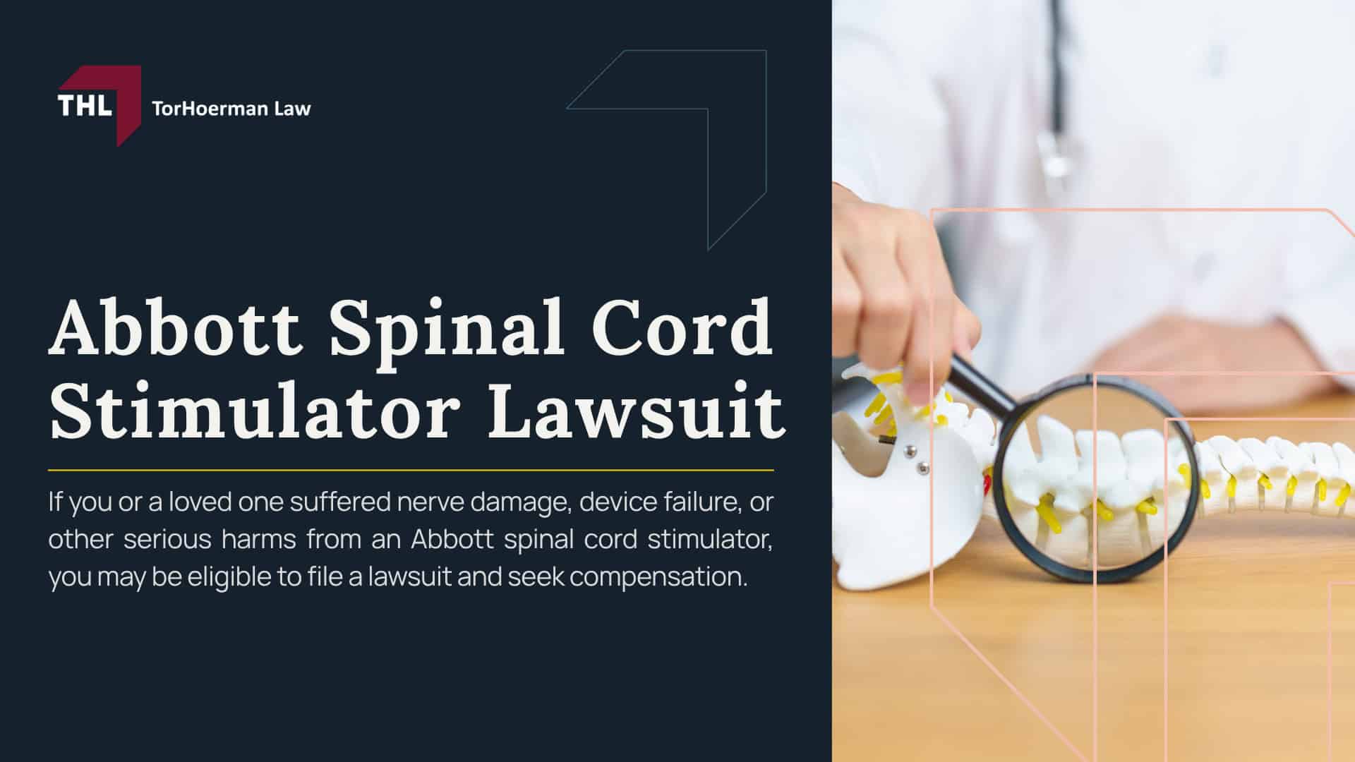 Abbott Spinal Cord Stimulator Lawsuit; Abbott Lawsuit Investigation Overview; Injuries and Complications Linked to Spinal Stimulators; Abbott Spinal Stimulators_ Overview; Spinal Cord Stimulator Lawsuit - Spinal Cord Stimulator Lawsuit - Do You Qualify for a Spinal Cord Stimulator Lawsuit_ - torhoerman law; Gathering Evidence for a Spinal Cord Stimulator Lawsuit; Damages in Spinal Stimulator Lawsuits; TorHoerman Law_ Investigating Spinal Cord Stimulator Lawsuit Claims; What Is the Abbott Spinal Cord Stimulator Lawsuit About; Abbott Lawsuit Investigation Overview; Spinal Cord Stimulator Risks_ Injuries and Complications; Abbott Spinal Stimulators_ Overview; Do You Qualify for a Abbott Spinal Cord Stimulator Lawsuit; Gathering Evidence for a Spinal Cord Stimulator Lawsuit; Damages in Spinal Stimulator Lawsuits; TorHoerman Law_ Investigating Spinal Cord Stimulator Lawsuit Claims