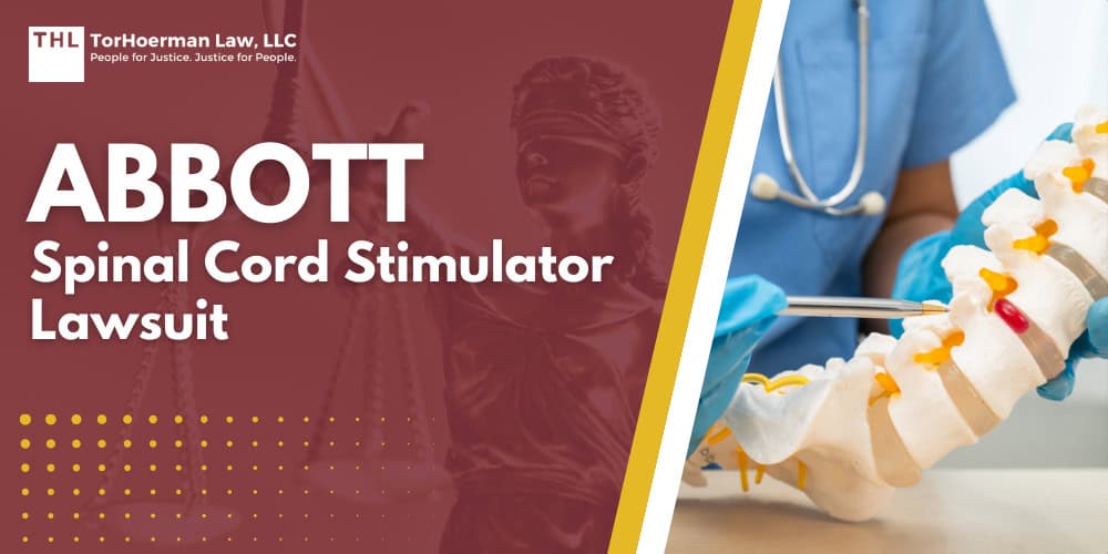 Abbott Spinal Cord Stimulator Lawsuit