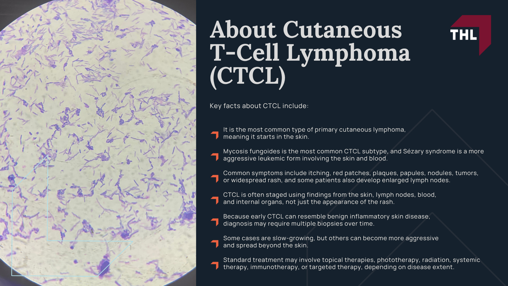 What Is Dupixent; Allegations Linking Dupixent To Lymphoma; About Cutaneous T-Cell Lymphoma (CTCL)