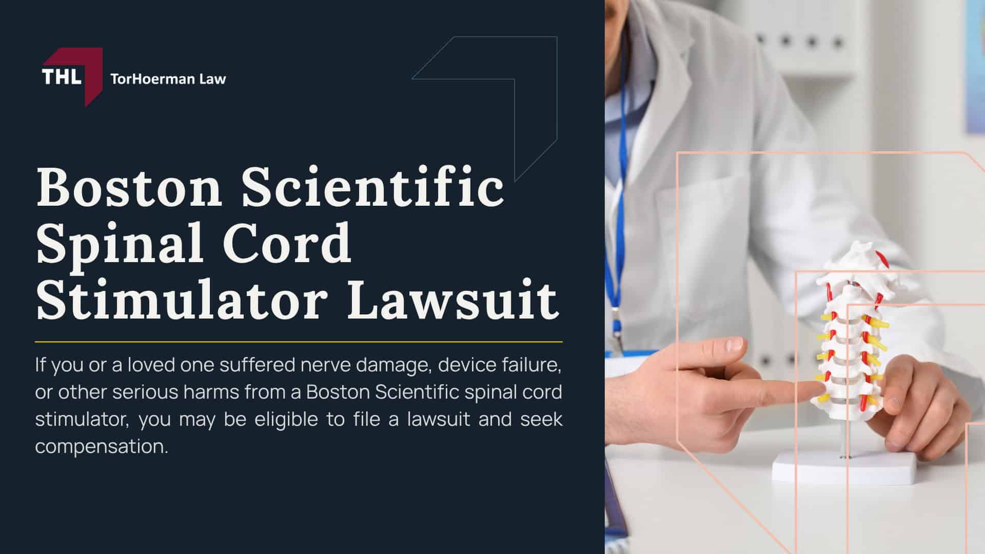 Boston Scientific Spinal Cord Stimulator Lawsuit; What Is the Boston Scientific Spinal Cord Stimulator Lawsuit About; Boston Scientific Spinal Cord Stimulator MDL Overview; Boston Scientific Spinal Stimulators_ Models Under Investigation; Spinal Cord Stimulator Risks_ Injuries and Complications; Do You Qualify for a Boston Scientific Spinal Stimulator Lawsuit; Gathering Evidence for a Spinal Cord Stimulator Lawsuit; Damages in Spinal Stimulator Lawsuits; TorHoerman Law_ Investigating Spinal Cord Stimulator Lawsuit Claims