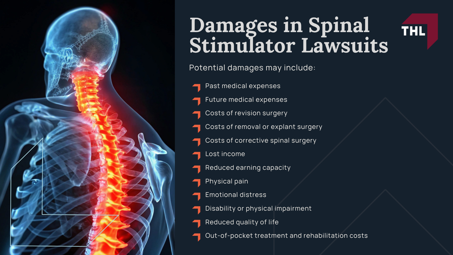Abbott Lawsuit Investigation Overview; Injuries and Complications Linked to Spinal Stimulators; Abbott Spinal Stimulators_ Overview;  Spinal Cord Stimulator Lawsuit - Spinal Cord Stimulator Lawsuit - Do You Qualify for a Spinal Cord Stimulator Lawsuit_ - torhoerman law; Gathering Evidence for a Spinal Cord Stimulator Lawsuit; Damages in Spinal Stimulator Lawsuits