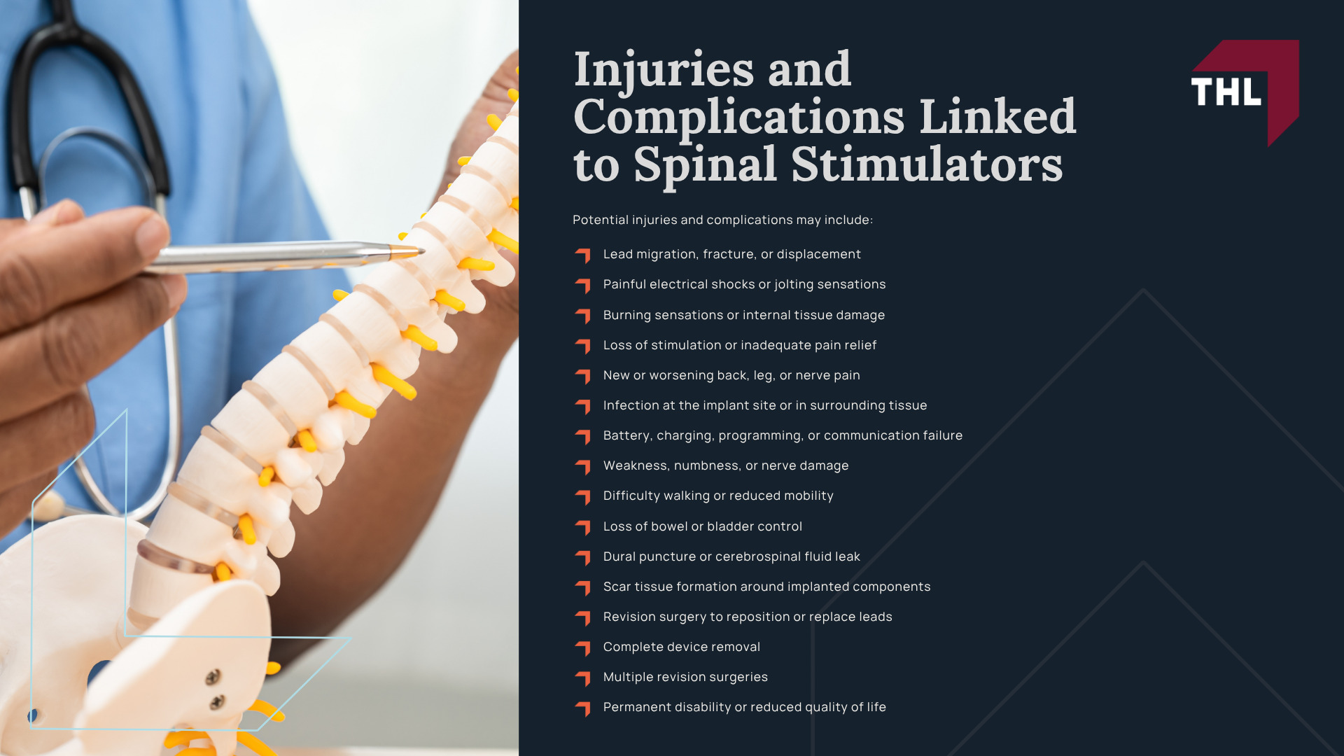 What Is the Nevro Spinal Cord Stimulator Lawsuit About; Nevro Spinal Cord Stimulator Lawsuit Status; Nevro Spinal Stimulators_ Overview; Injuries and Complications Linked to Spinal Stimulators