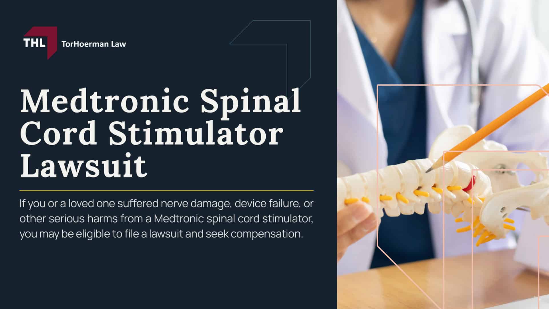 Medtronic Spinal Cord Stimulator Lawsuit; Medtronic Spinal Stimulator Lawsuit Investigation Overview; Injuries and Complications Linked to Spinal Stimulators; Medtronic Spinal Stimulators; Do You Qualify for a Medtronic Lawsuit; Gathering Evidence for a Spinal Cord Stimulator Lawsuit; Damages in Spinal Stimulator Lawsuits; TorHoerman Law_ Investigating Spinal Cord Stimulator Lawsuit Claims; What Is the Medtronic Spinal Cord Stimulator Lawsuit About; Medtronic Spinal Stimulators Under Investigation; Spinal Cord Stimulator Risks_ Injuries and Complications; Do You Qualify for a Medtronic Spinal Stimulator Lawsuit; Gathering Evidence for a Spinal Cord Stimulator Lawsuit; Damages in Spinal Stimulator Lawsuits; TorHoerman Law_ Investigating Spinal Cord Stimulator Lawsuit Claims