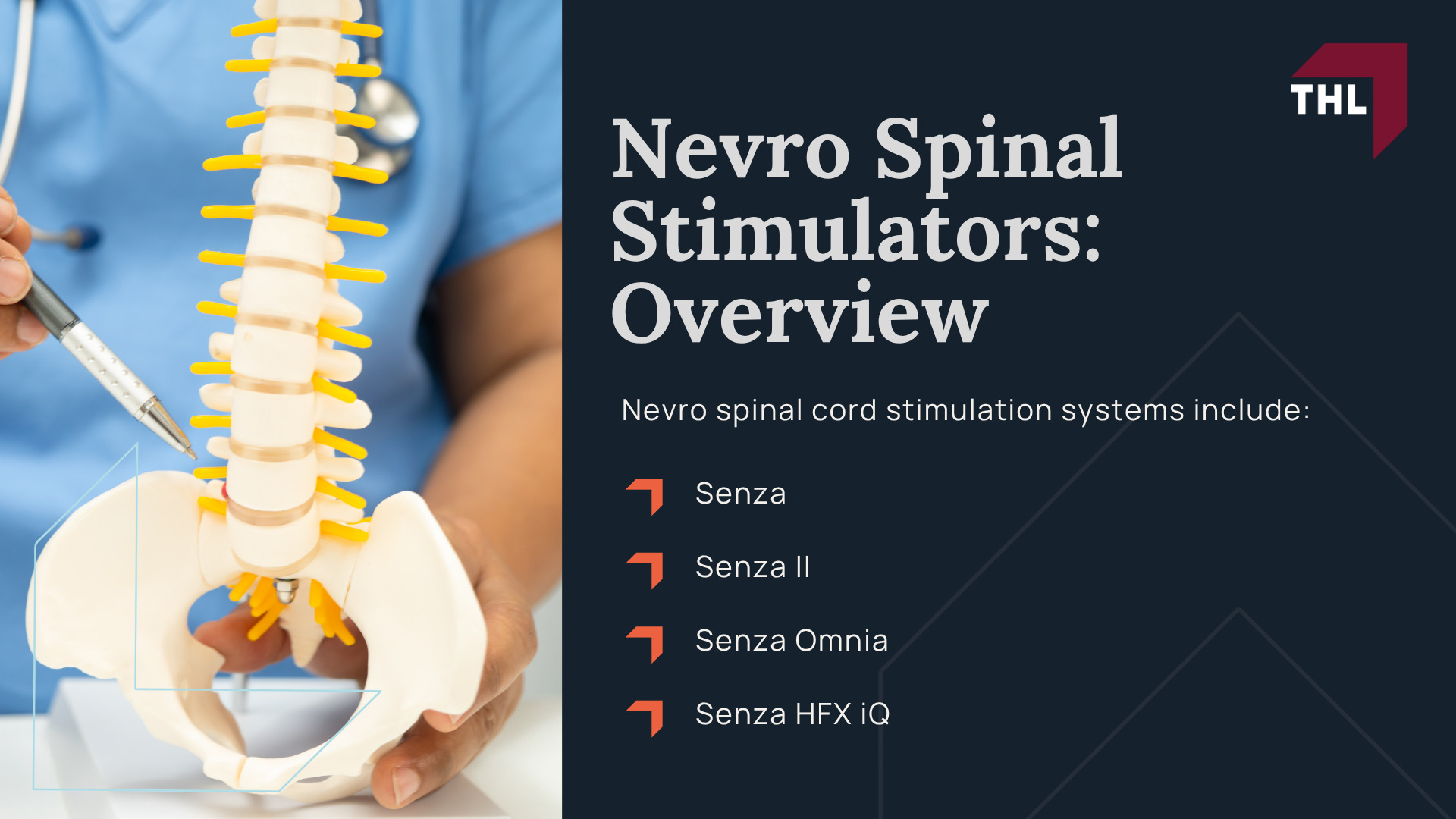 What Is the Nevro Spinal Cord Stimulator Lawsuit About; Nevro Spinal Cord Stimulator Lawsuit Status; Nevro Spinal Stimulators_ Overview