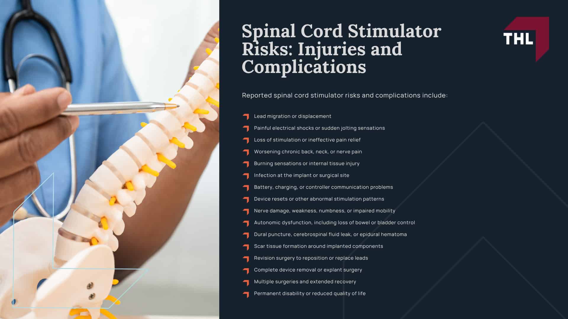 What Is the Boston Scientific Spinal Cord Stimulator Lawsuit About; Boston Scientific Spinal Cord Stimulator MDL Overview; Boston Scientific Spinal Stimulators_ Models Under Investigation; Spinal Cord Stimulator Risks_ Injuries and Complications