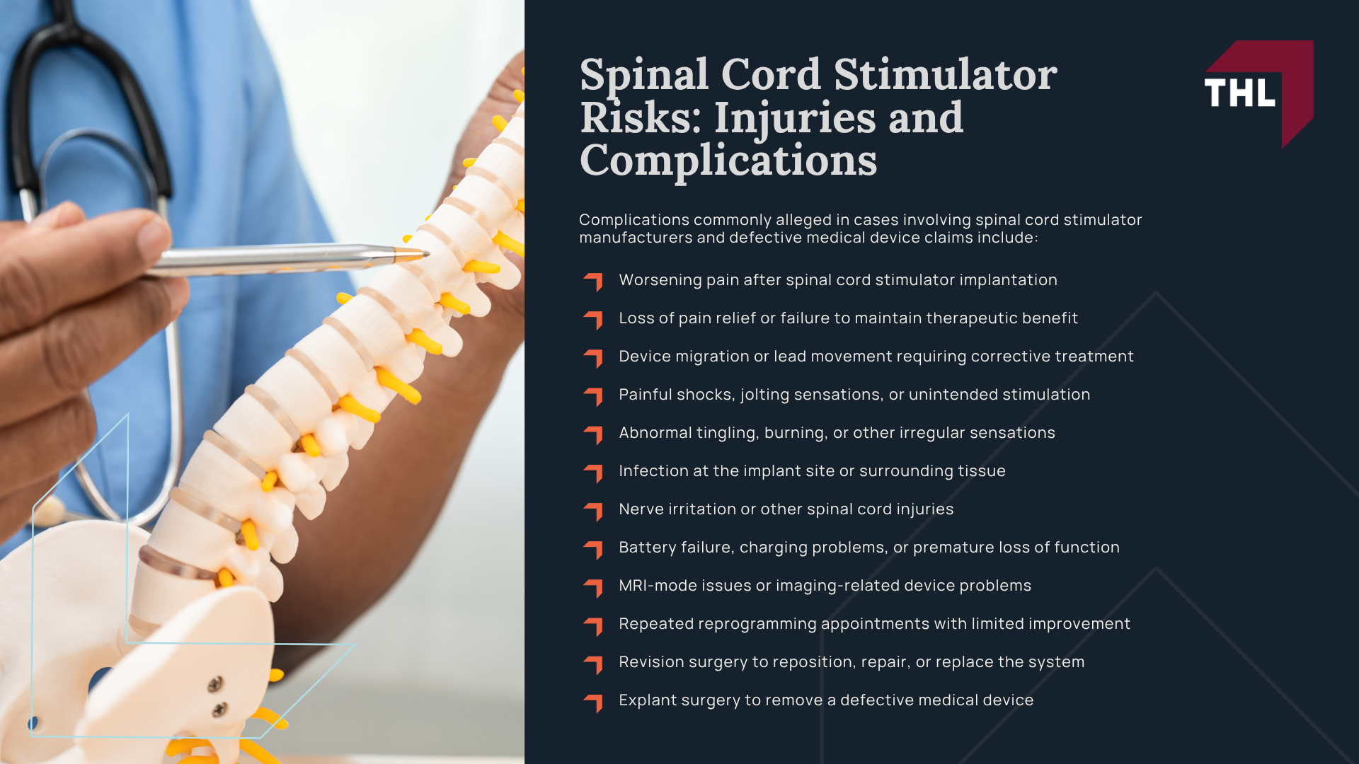 What Is the Abbott Spinal Cord Stimulator Lawsuit About; Abbott Lawsuit Investigation Overview; Spinal Cord Stimulator Risks_ Injuries and Complications