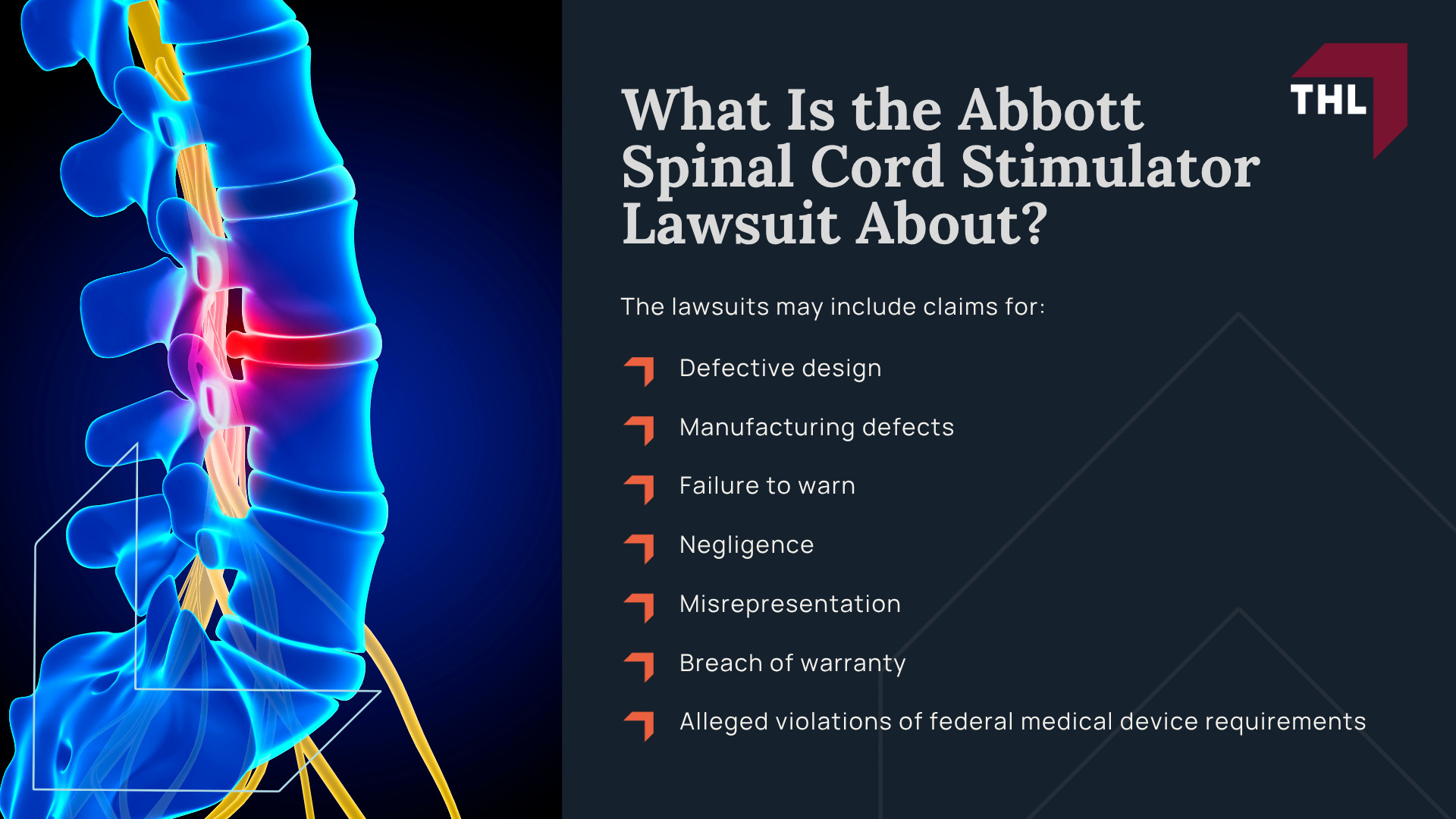 What Is the Abbott Spinal Cord Stimulator Lawsuit About