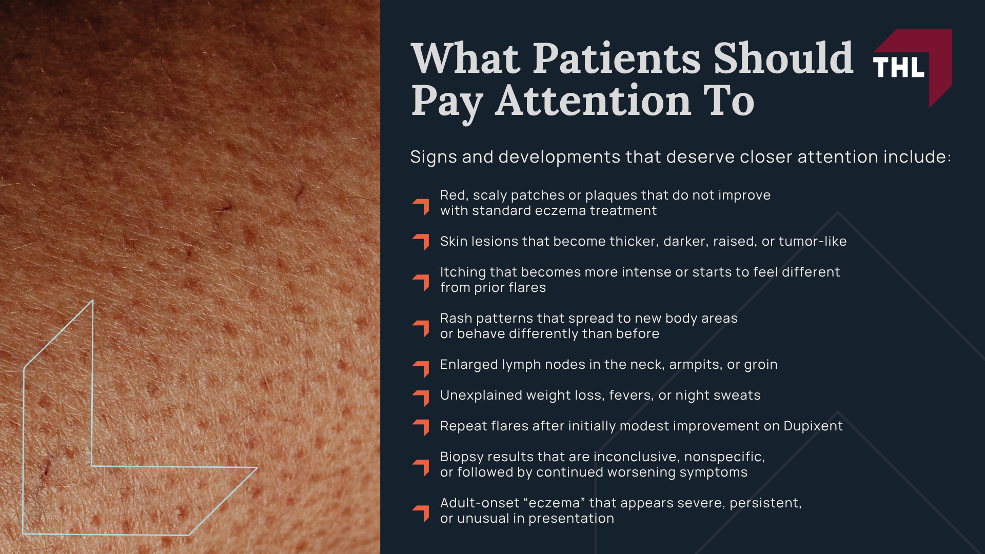 Where The Dupixent–Lymphoma Question Comes From; What Dupixent Is Designed To Do; How is Dupixent Potentially Linked to Lymphoma; FDA Review And Safety Monitoring; What Patients Should Pay Attention To