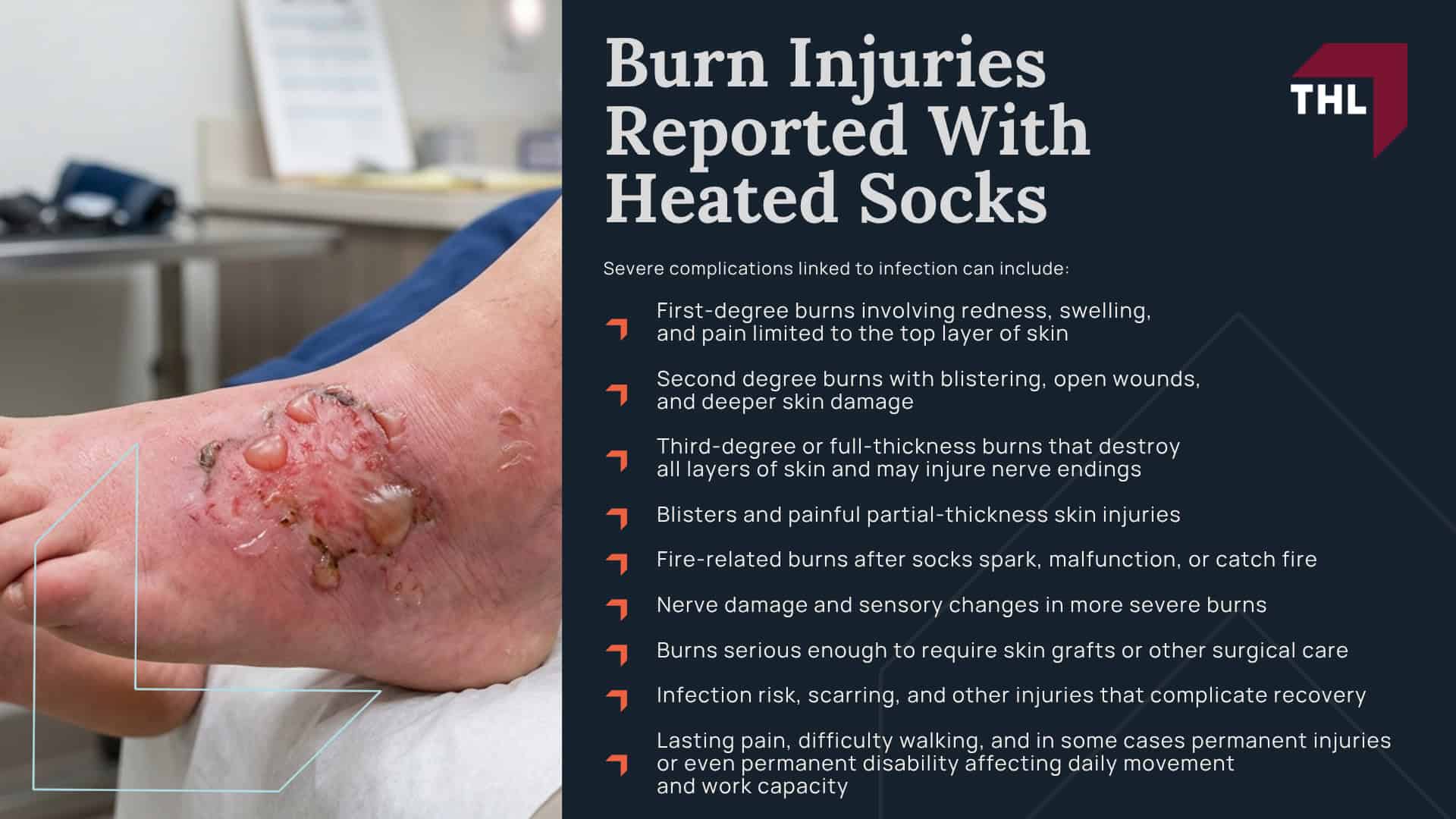 Why Heated Socks Can Become Especially Dangerous Inside Shoes and Boots; Why Heated Socks Can Become Especially Dangerous Inside Shoes and Boots; Potentially Defective Heated Socks Named in Safety Warnings and Recalls; Burn Injuries Reported With Heated Socks