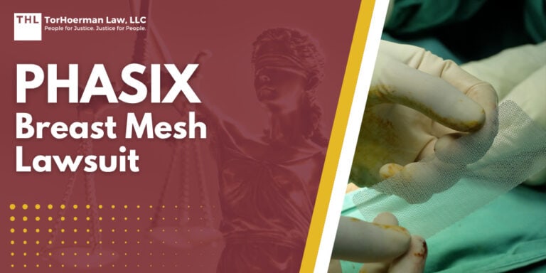 Phasix Breast Mesh Lawsuit