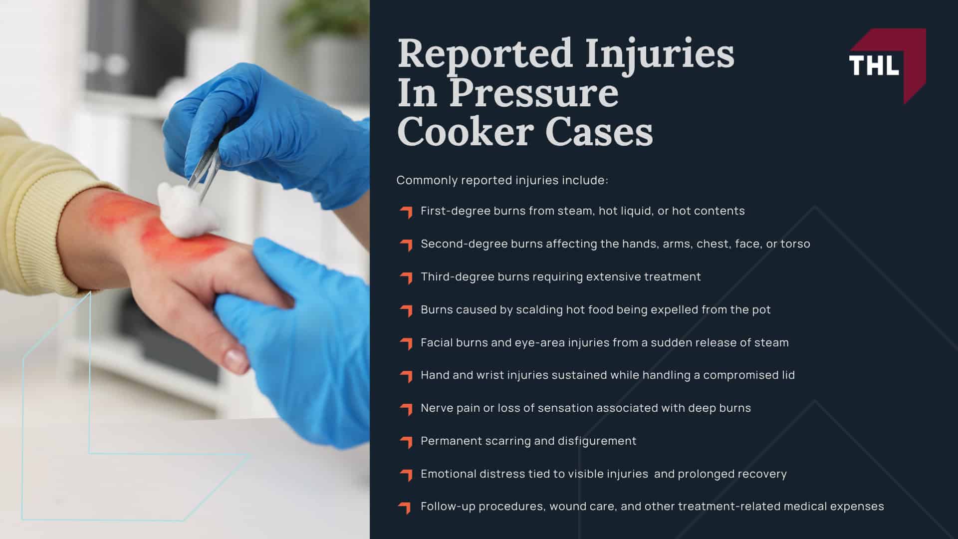Reports Of Burn Injuries Linked To Mueller Pressure Cookers; What Mueller Pressure Cooker Models Are Being Investigated; Reported Injuries In Pressure Cooker Cases