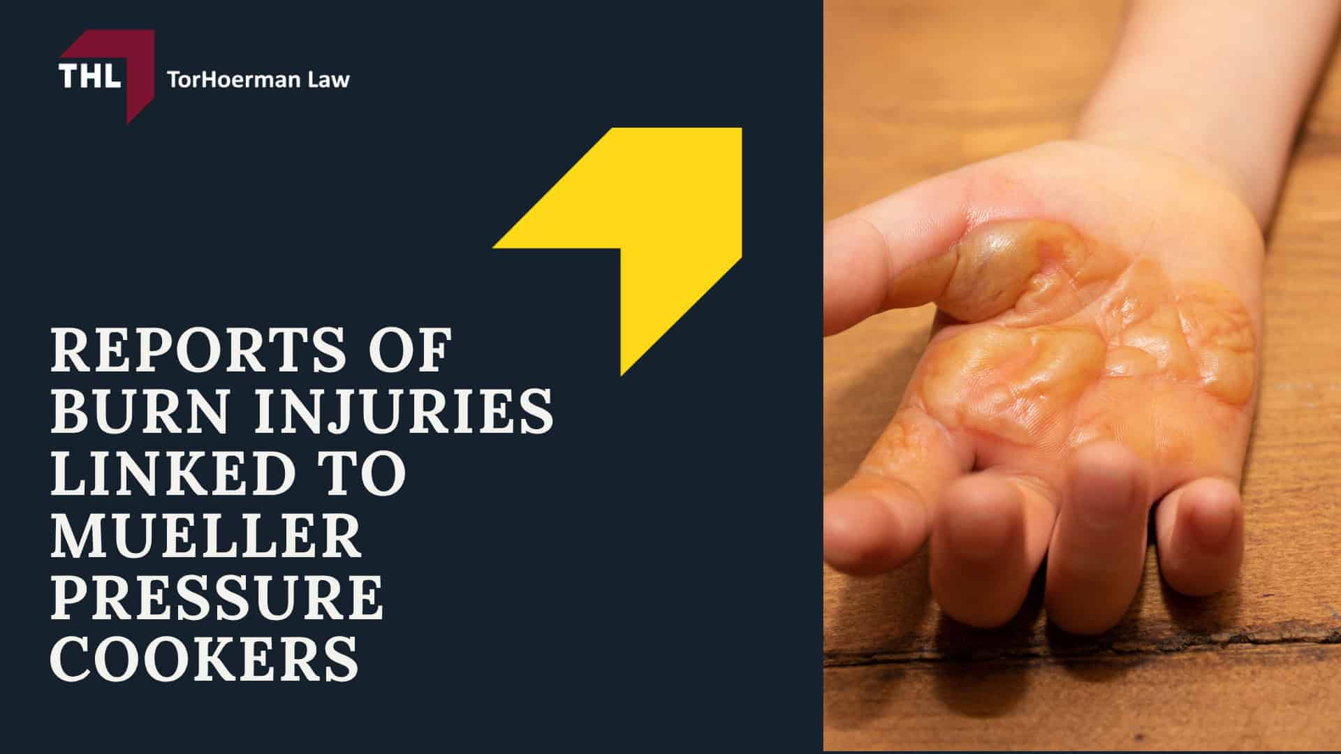 Reports Of Burn Injuries Linked To Mueller Pressure Cookers