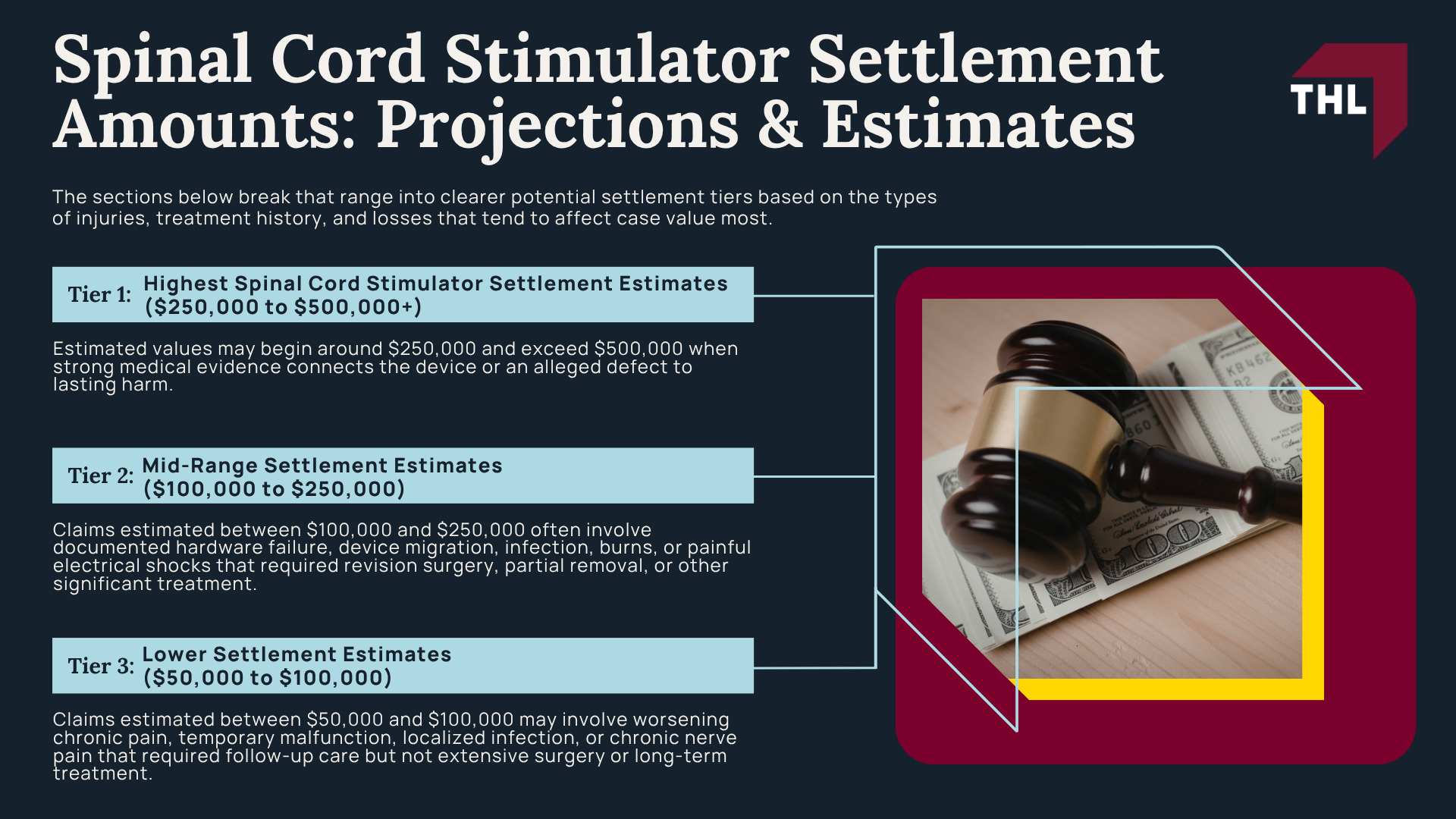 Spinal Cord Stimulator Lawsuit Overview