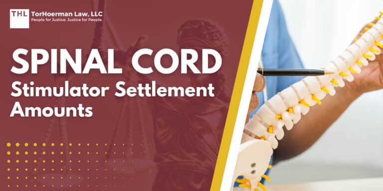 Spinal Cord Stimulator Settlement Amounts
