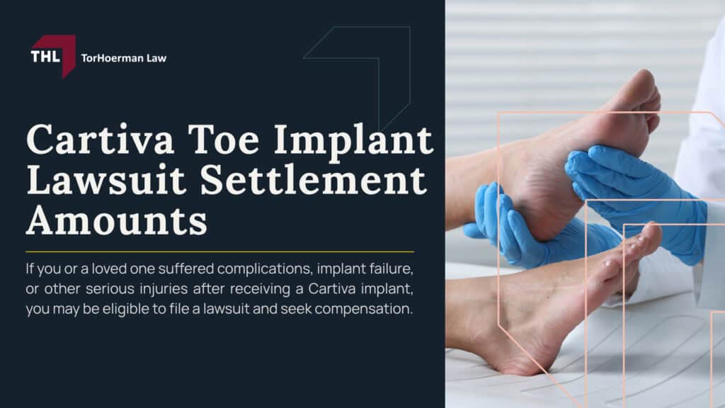 Cartiva Toe Implant Lawsuit Settlement Amounts; Cartiva Toe Implant Lawsuit Settlement Amounts_ Estimates & Projections; Factors That May Affect Cartiva Settlement Amounts; Cartiva Implant Lawsuit Overview; Reported Failure Rates and Medical Evidence; MDL No. 3172 and Ongoing Litigation; Who May Qualify for a Cartiva Implant Lawsuit; TorHoerman Law_ Accepting Cases for the Cartiva Toe Implant Lawsuit