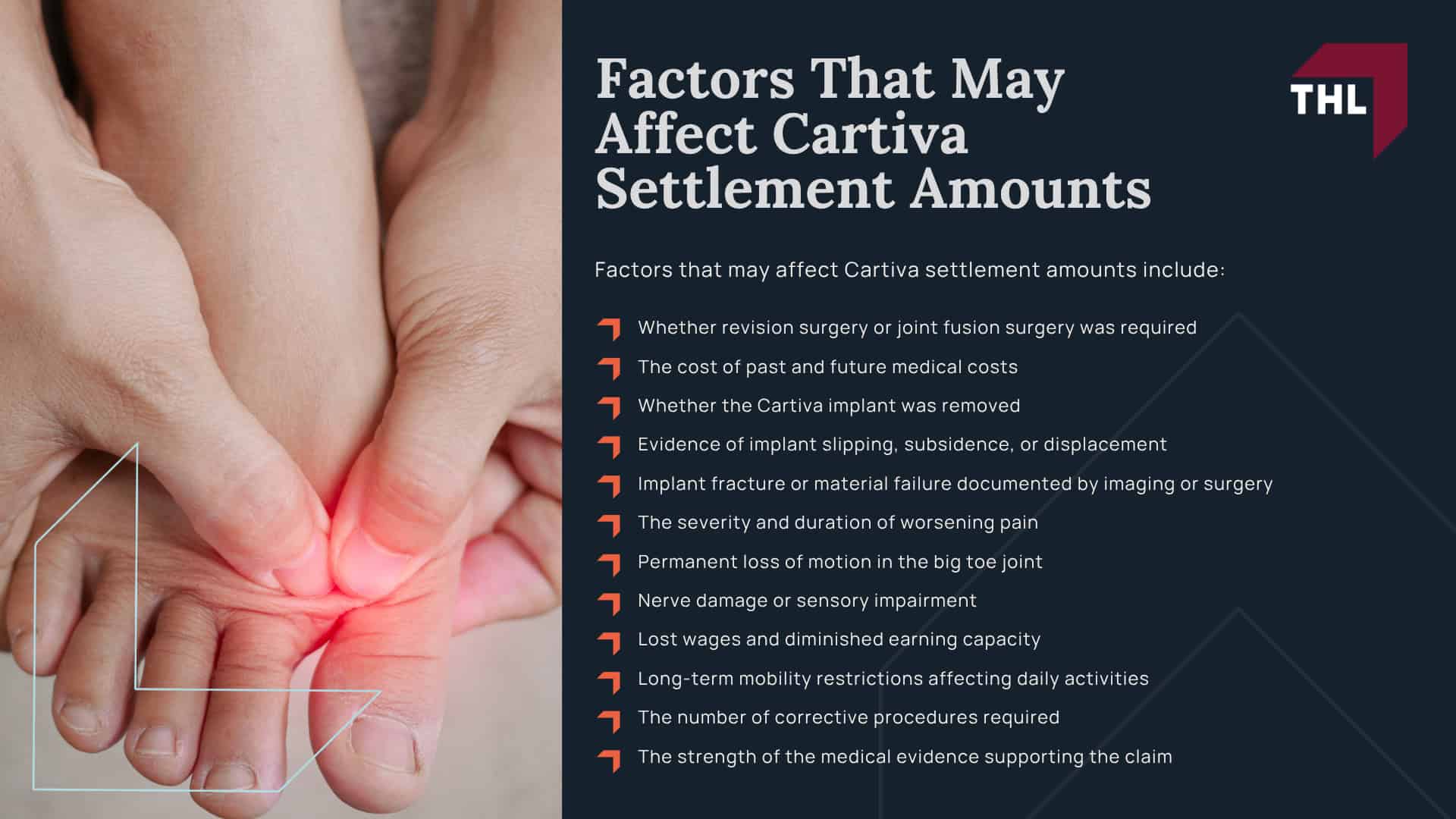 Cartiva Toe Implant Lawsuit Settlement Amounts_ Estimates & Projections; Factors That May Affect Cartiva Settlement Amounts