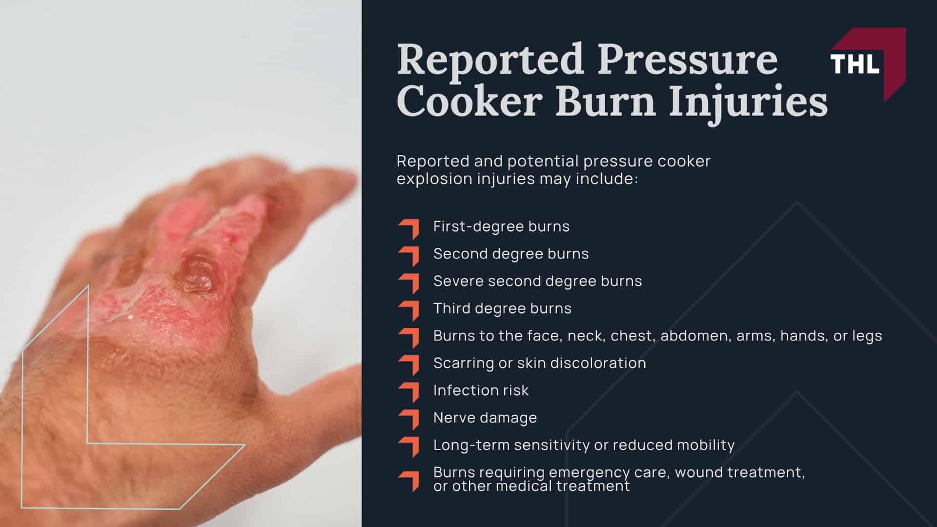 What Is the Gourmia Pressure Cooker Lawsuit Investigation; CPSC Warning for Gourmia Pressure Cookers; Which Gourmia Pressure Cooker Models Are Affected; Why CPSC Says Gourmia Pressure Cookers Pose a Burn Risk; Reported Pressure Cooker Burn Injuries