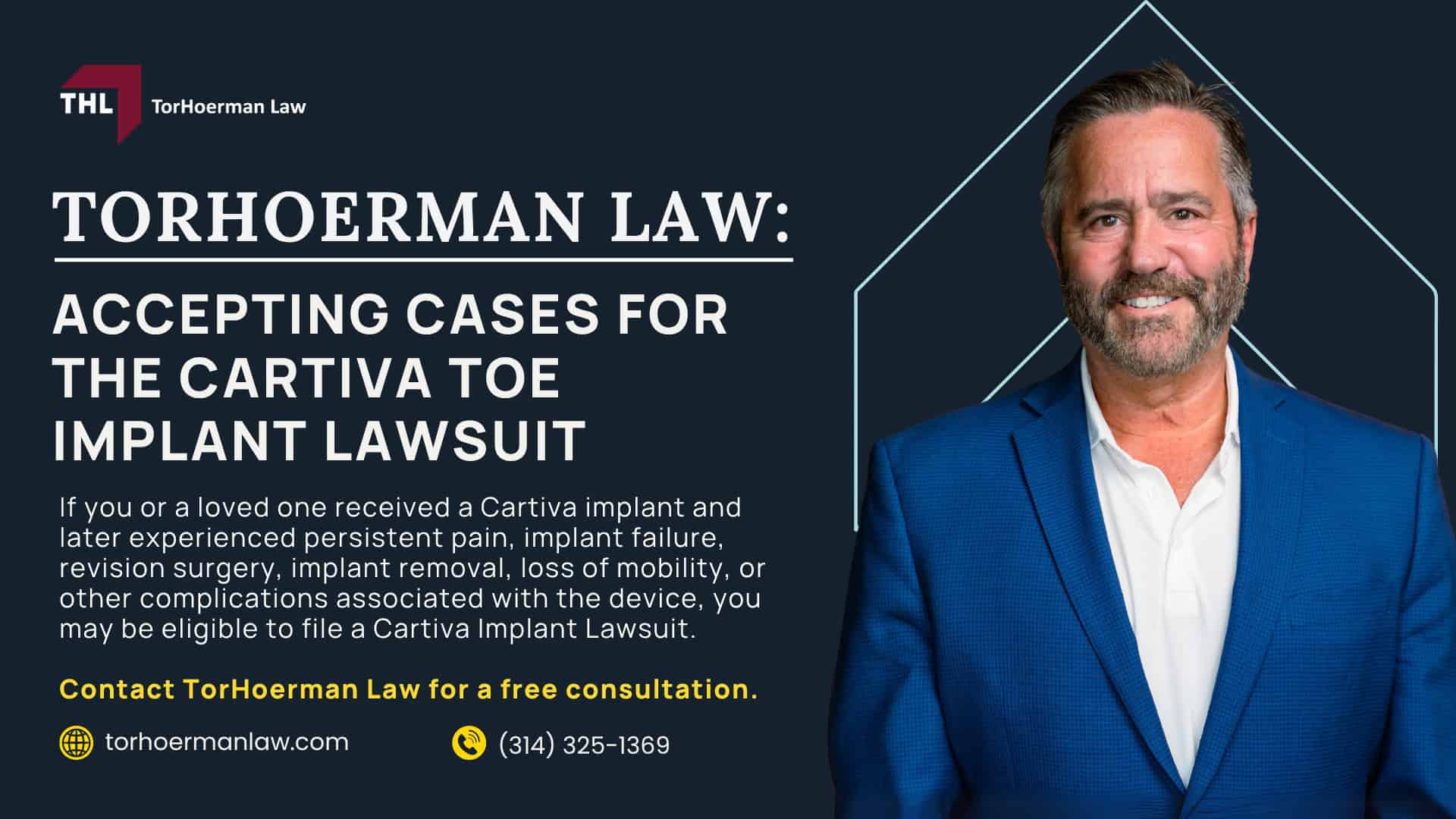 Cartiva Toe Implant Lawsuit Settlement Amounts_ Estimates & Projections; Factors That May Affect Cartiva Settlement Amounts; Cartiva Implant Lawsuit Overview; Reported Failure Rates and Medical Evidence; MDL No. 3172 and Ongoing Litigation; Who May Qualify for a Cartiva Implant Lawsuit; TorHoerman Law_ Accepting Cases for the Cartiva Toe Implant Lawsuit