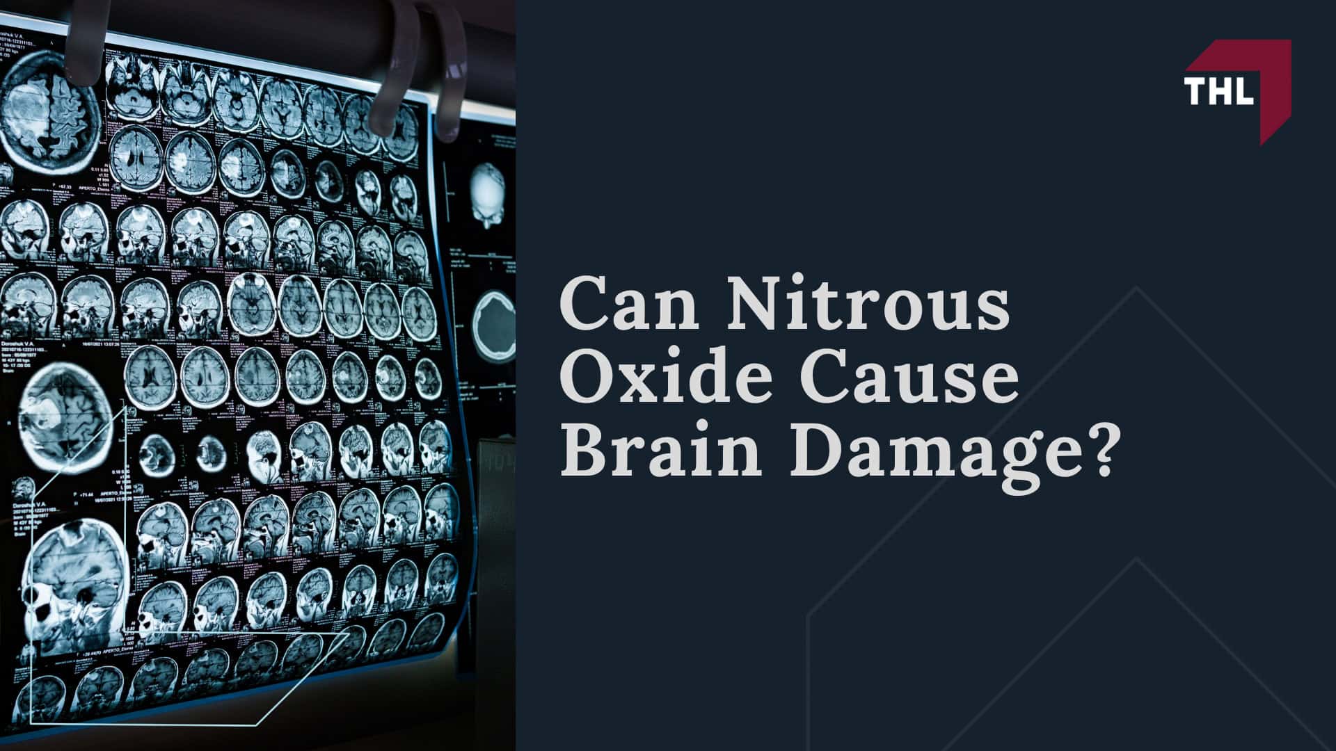 What is the Nitrous Oxide Brain Damage Lawsuit; Nitrous Oxide Products Linked to Brain Damage Claims; Why People Are Filing Nitrous Oxide Brain Damage Lawsuits; Allegations Against Nitrous Oxide Companies; Can Nitrous Oxide Cause Brain Damage