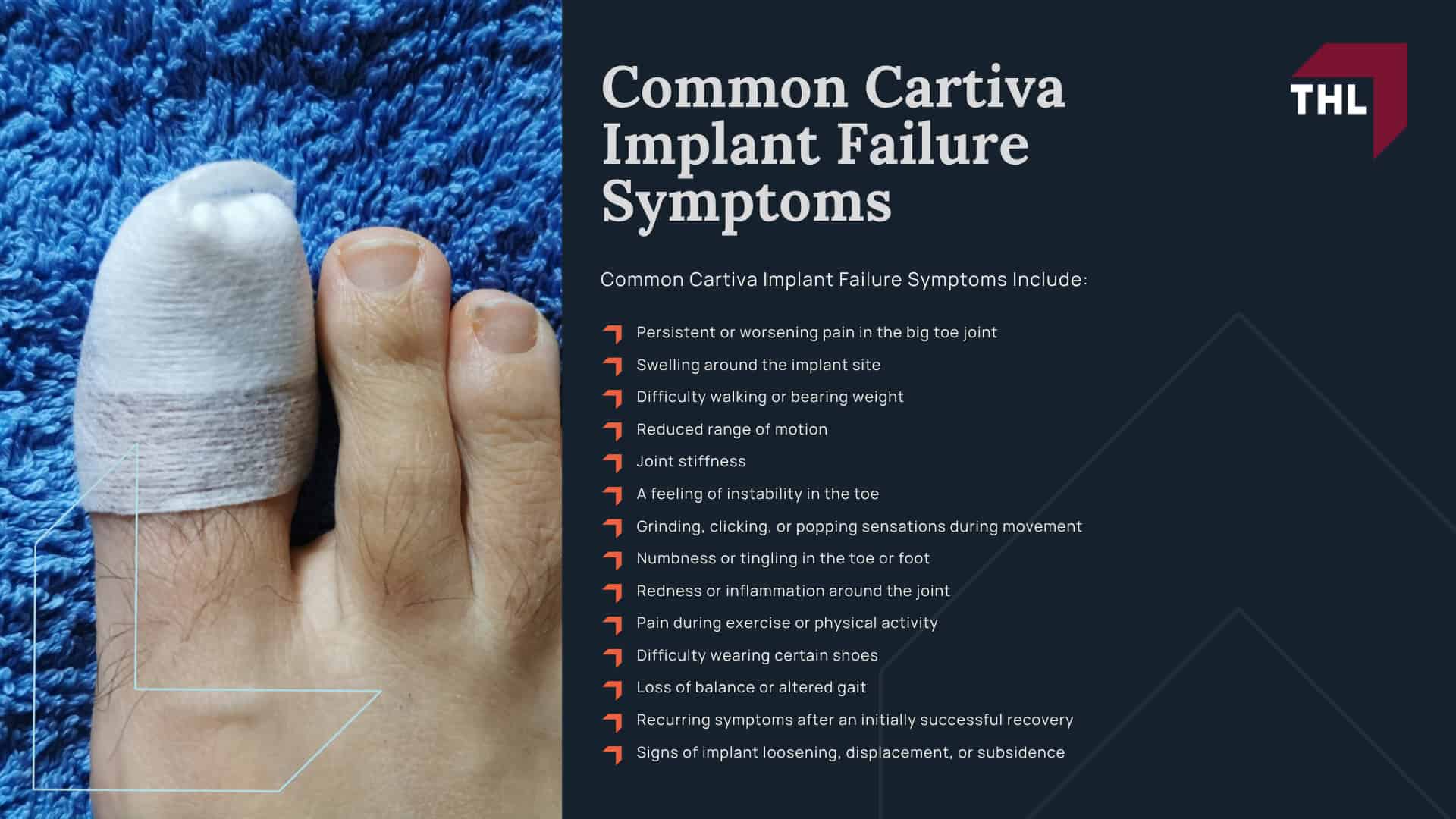 Basic Eligibility Requirements for a Cartiva Claim; Injuries That May Qualify for a Cartiva Lawsuit; Common Cartiva Implant Failure Symptoms