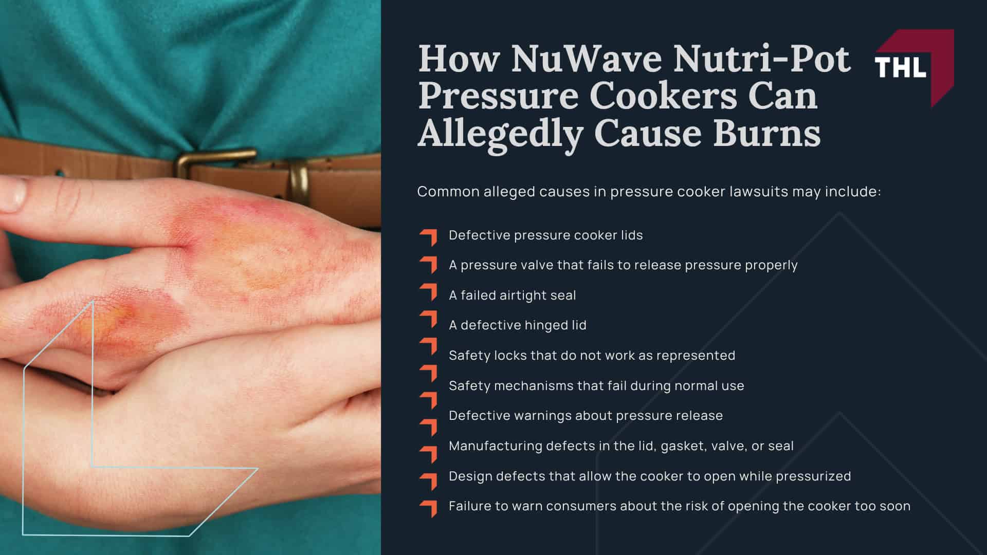 What Is the NuWave Nutri-Pot Pressure Cooker Lawsuit About; Why NuWave Nutri-Pot Pressure Cookers May Pose a Burn Risk; Reported NuWave Nutri-Pot Pressure Cooker Burn Injuries; How NuWave Nutri-Pot Pressure Cookers Can Allegedly Cause Burns
