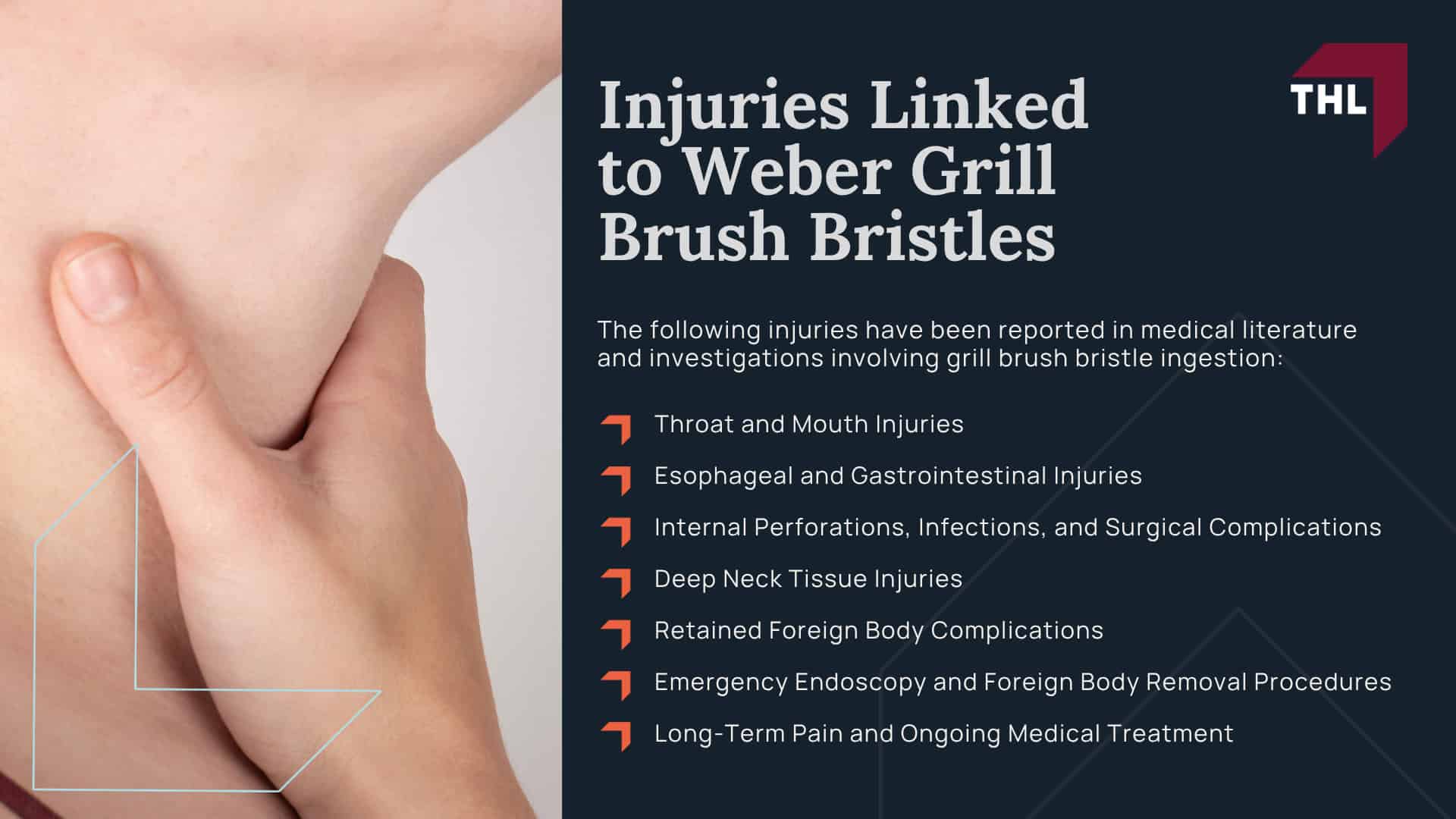 Weber Recalled 3.2 Million Grill Brushes After Reports of Detached Wire Bristles; Which Weber Grill Brushes Were Recalled; What Consumers Should Do If They Own a Recalled Brush; Why Detached Grill Brush Bristles Can Cause Serious Injuries; How Metal Bristles End Up in Food; What Happens After a Bristle Is Swallowed; Injuries Linked to Weber Grill Brush Bristles