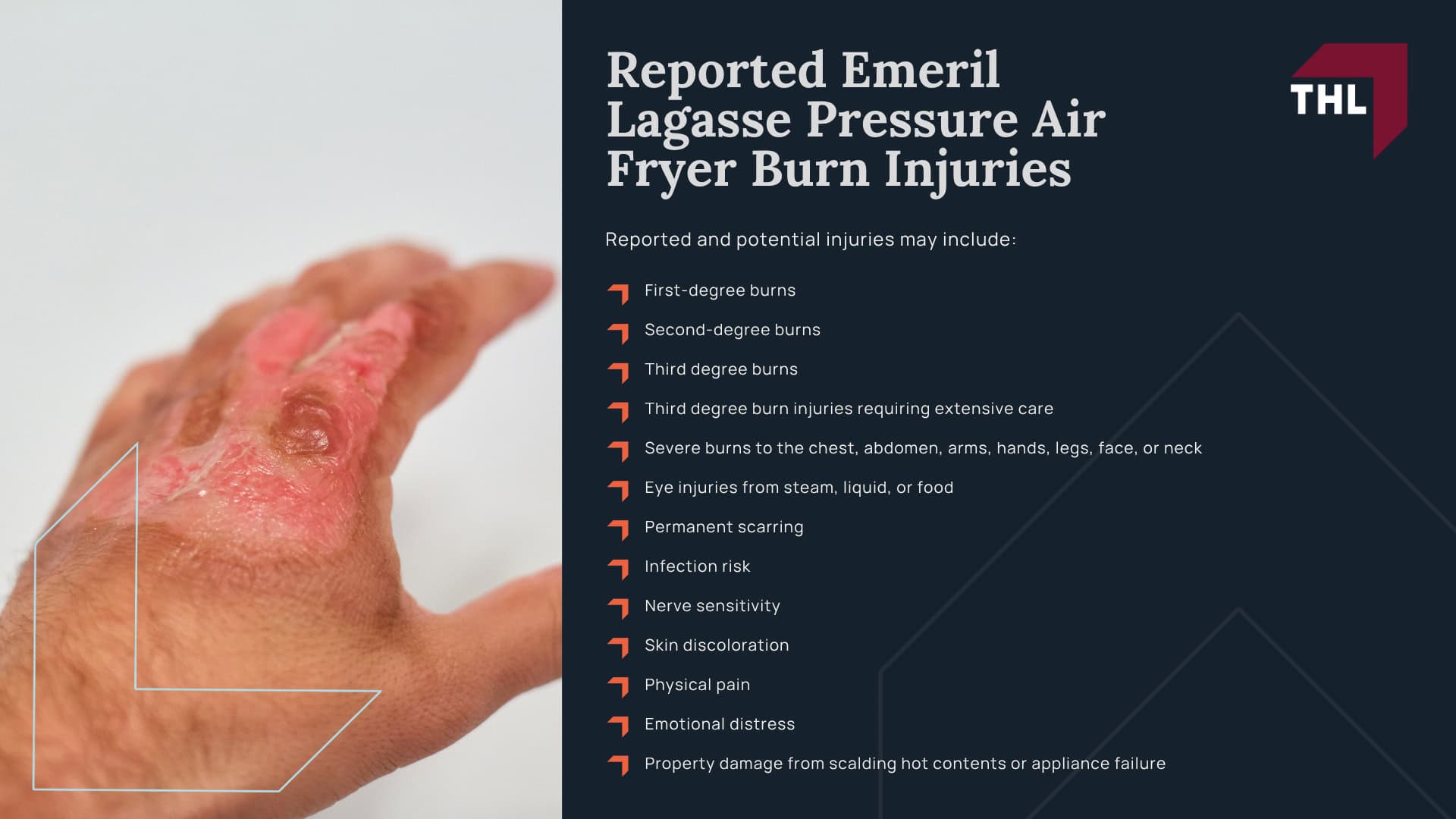 What Is the Emeril Lagasse Pressure Air Fryer Lawsuit Investigation About?; Are Emeril Lagasse Pressure Air Fryers Recalled; Which Emeril Lagasse Pressure Air Fryer Models May Be Involved; Why Emeril Lagasse Pressure Air Fryers May Pose a Burn Risk; Reported Emeril Lagasse Pressure Air Fryer Burn Injuries