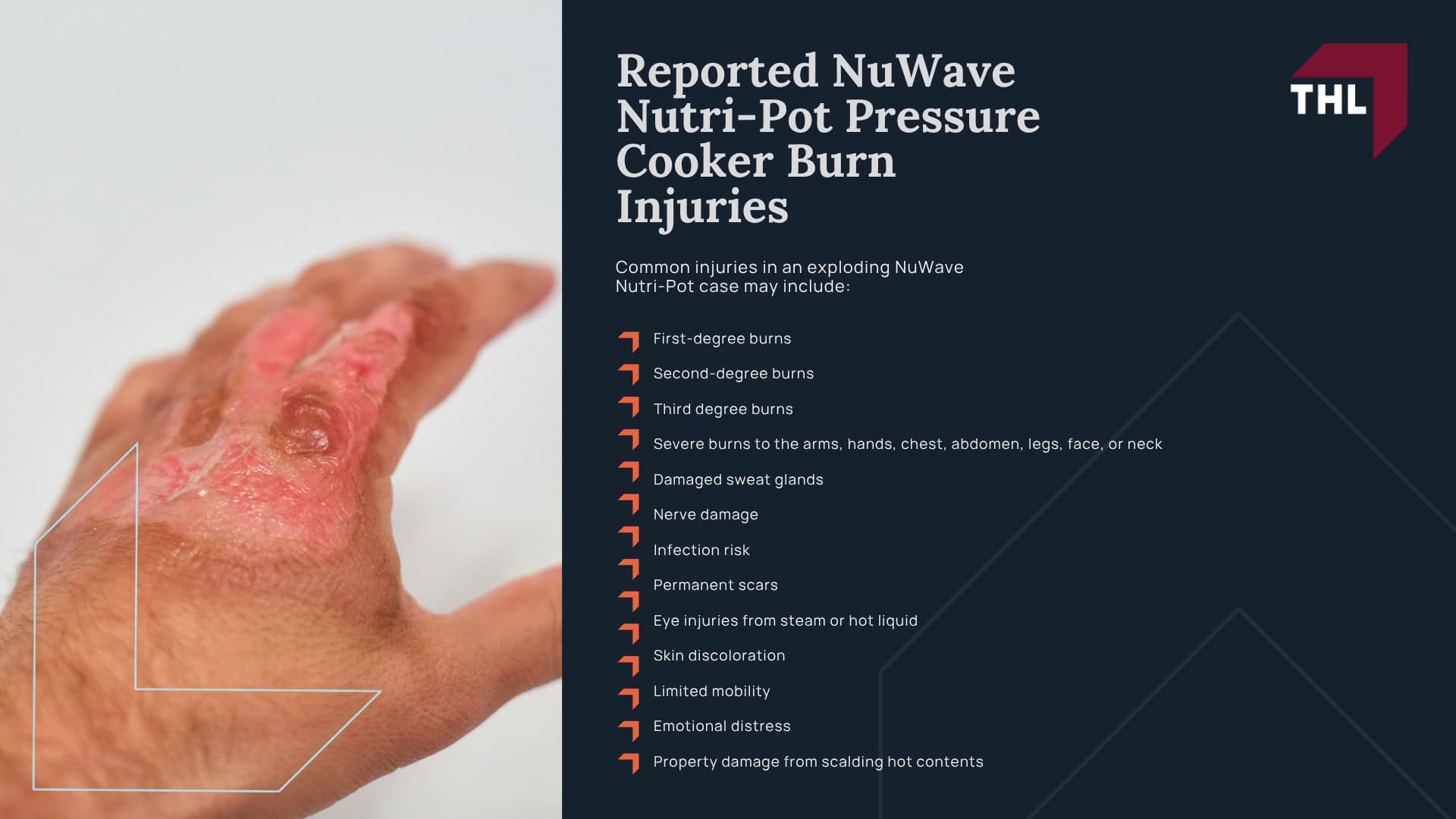 What Is the NuWave Nutri-Pot Pressure Cooker Lawsuit About; Why NuWave Nutri-Pot Pressure Cookers May Pose a Burn Risk; Reported NuWave Nutri-Pot Pressure Cooker Burn Injuries