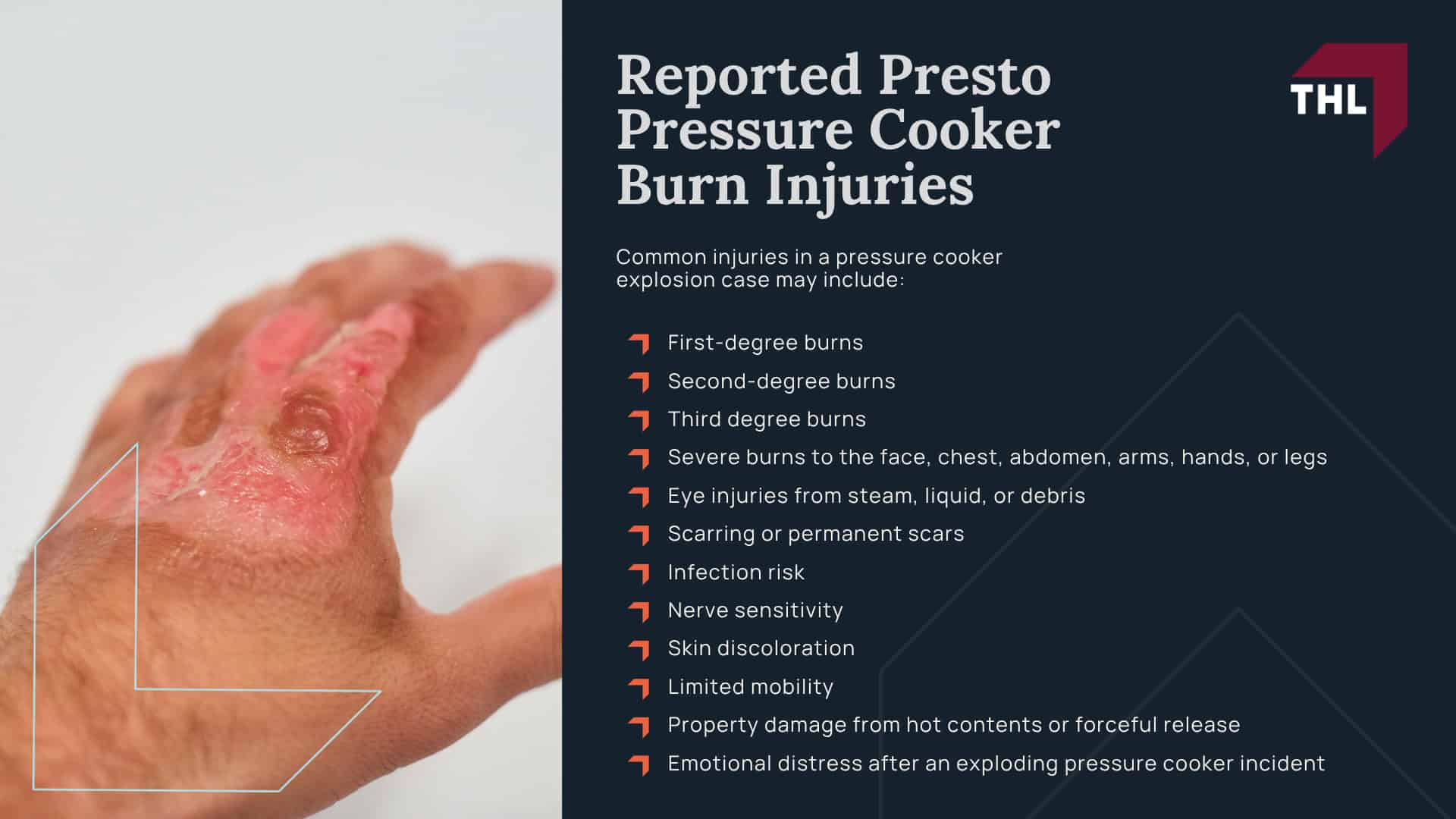 What Is the Presto Pressure Cooker Lawsuit About; Are Presto Pressure Cookers Recalled; Which Presto Pressure Cooker Models May Be Involved; Why Presto Pressure Cookers May Pose a Burn Risk; Reported Presto Pressure Cooker Burn Injuries