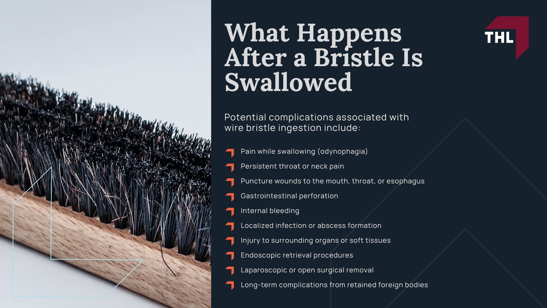Weber Recalled 3.2 Million Grill Brushes After Reports of Detached Wire Bristles; Which Weber Grill Brushes Were Recalled; What Consumers Should Do If They Own a Recalled Brush; Why Detached Grill Brush Bristles Can Cause Serious Injuries; How Metal Bristles End Up in Food; What Happens After a Bristle Is Swallowed