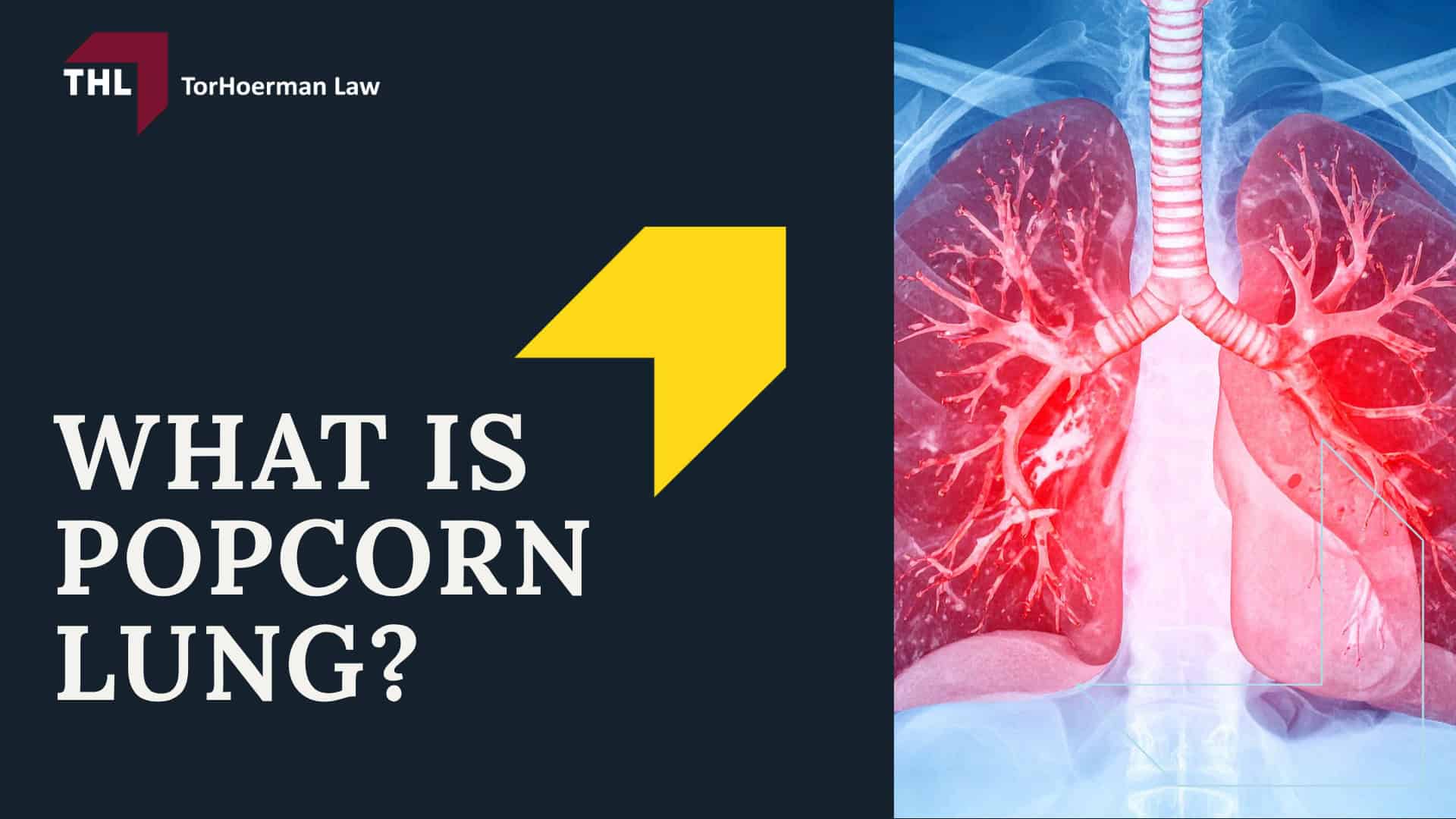 What Is Popcorn Lung