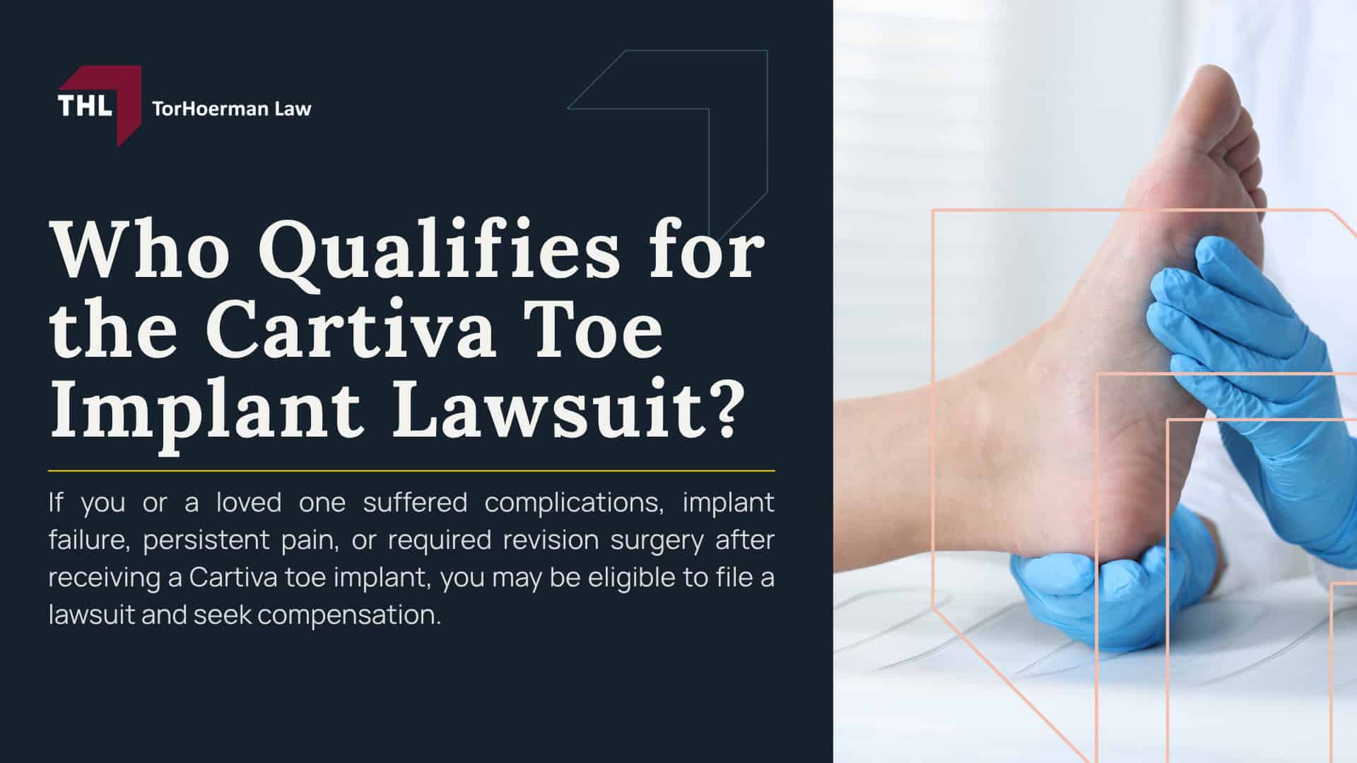 Who Qualifies for the Cartiva Toe Implant Lawsuit; Basic Eligibility Requirements for a Cartiva Claim; Injuries That May Qualify for a Cartiva Lawsuit; Common Cartiva Implant Failure Symptoms; Who Is Most Likely to Have a Strong Cartiva Lawsuit; What Evidence Can Help Support a Cartiva Claim; Who May Not Qualify for a Cartiva Lawsuit; TorHoerman Law_ Reviewing Cartiva Implant Lawsuits