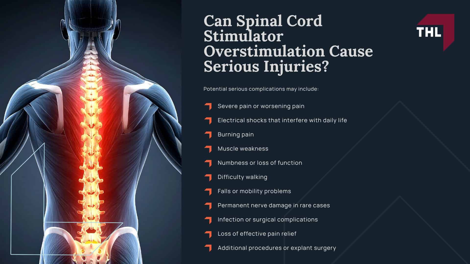 What Is Spinal Cord Stimulator Overstimulation; Common Symptoms of Spinal Cord Stimulator Overstimulation; When Are Overstimulation Symptoms a Warning Sign of Bigger Problems; What Causes Spinal Cord Stimulator Overstimulation; What Is Spinal Cord Stimulator Overstimulation; Common Symptoms of Spinal Cord Stimulator Overstimulation; When Are Overstimulation Symptoms a Warning Sign of Bigger Problems; What Causes Spinal Cord Stimulator Overstimulation