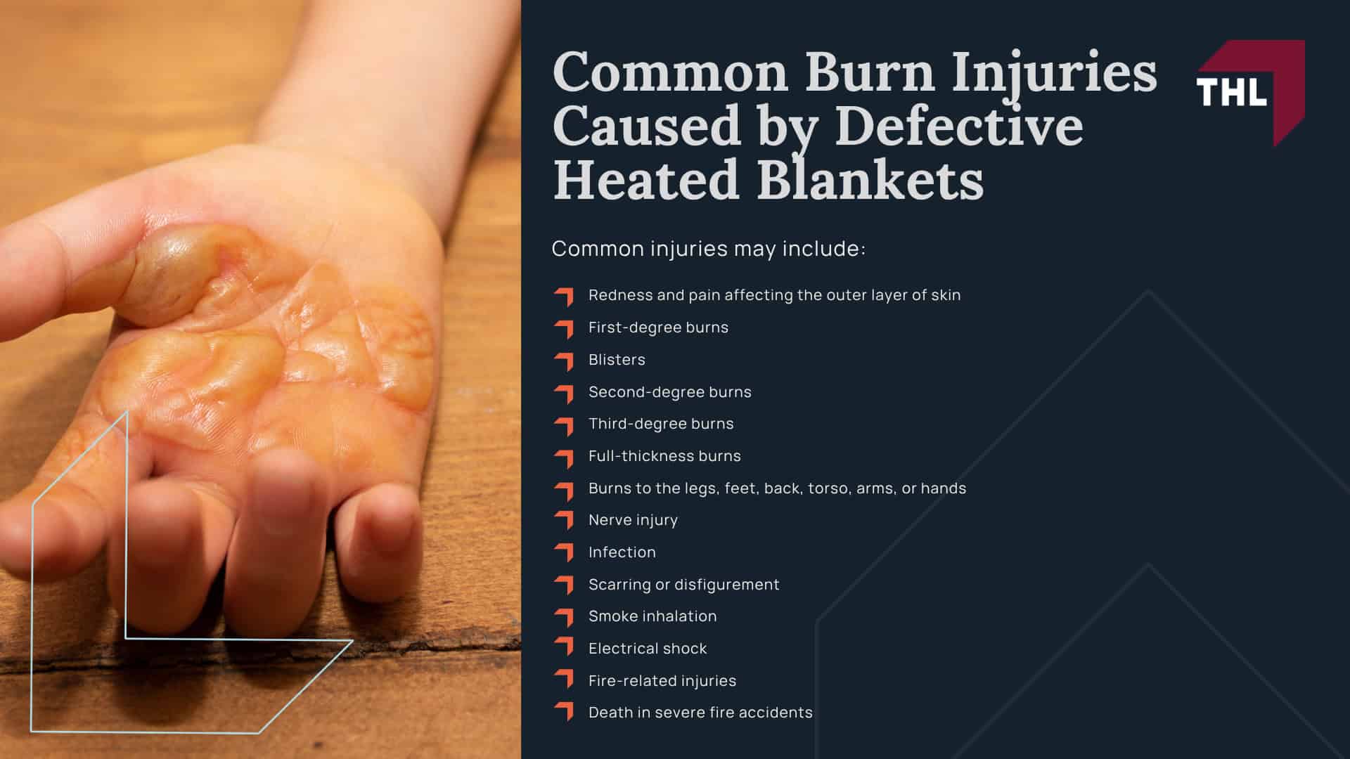 Electric Blankets, Heated Throws, and Heated Pads Linked to Burn Risks; How Heated Blankets Can Cause Burn Injuries; Recalls and CPSC Warnings Involving Heated Blankets; Common Burn Injuries Caused by Defective Heated Blankets