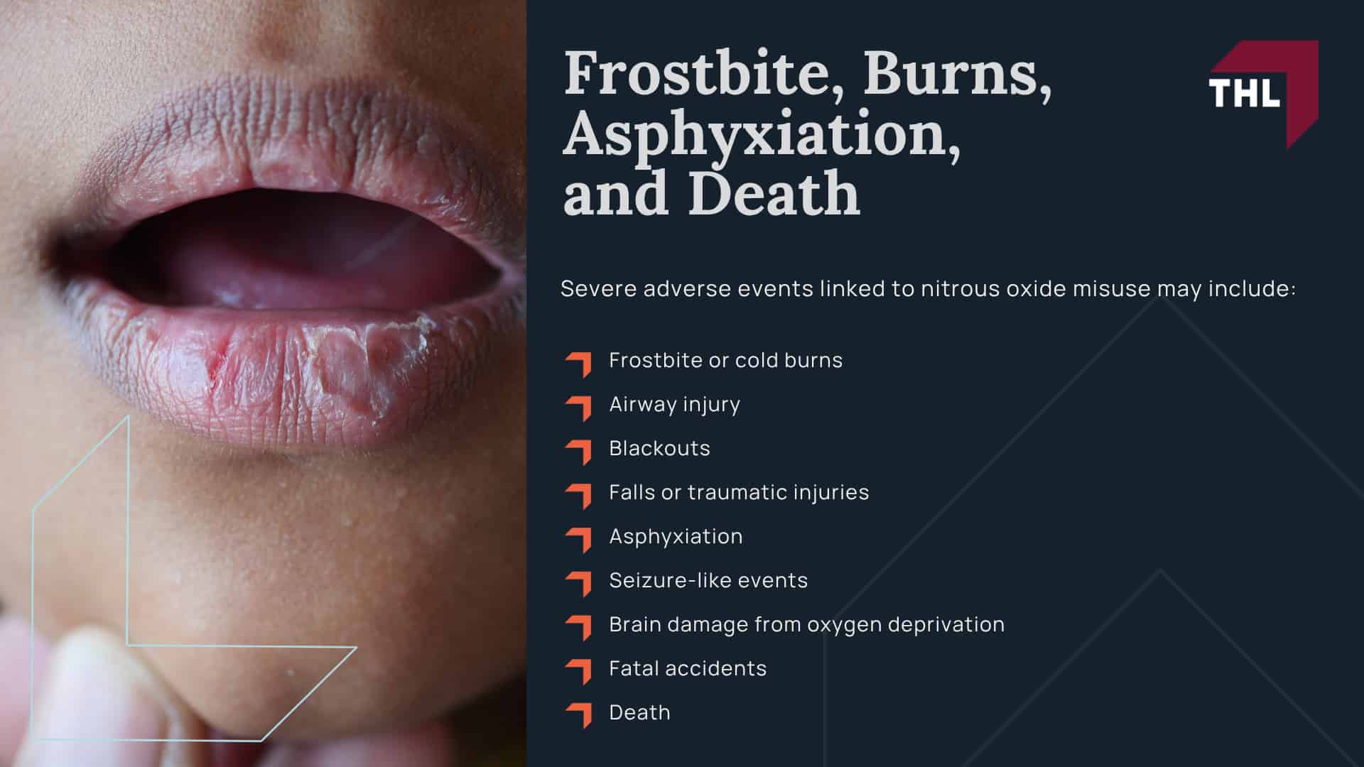 What Is Baking Bad Nitrous Oxide; Why Are Baking Bad Nitrous Oxide Products Being Investigated; Nitrous Oxide Side Effects and Injuries; Neurological Damage and Spinal Cord Injuries; Paralysis, Trouble Walking, and Loss of Coordination; Brain Damage, Memory Loss, and Psychiatric Symptoms; Blood Clots, Pulmonary Embolism, and Heart Problems; Frostbite, Burns, Asphyxiation, and Death